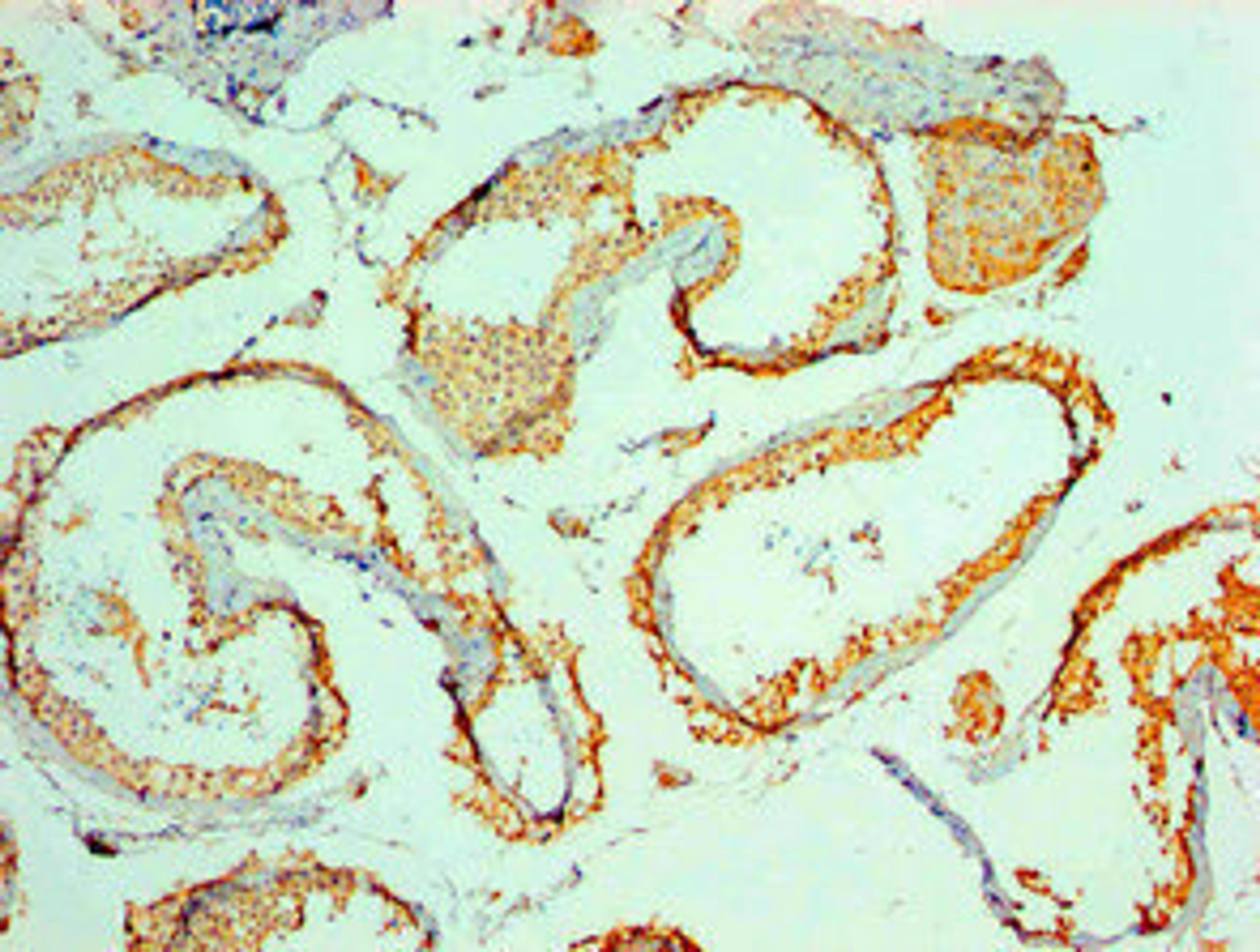 Immunohistochemical of paraffin-embedded Human testis tissue using CSB-MA8587101A0m at dilution of 1:200.