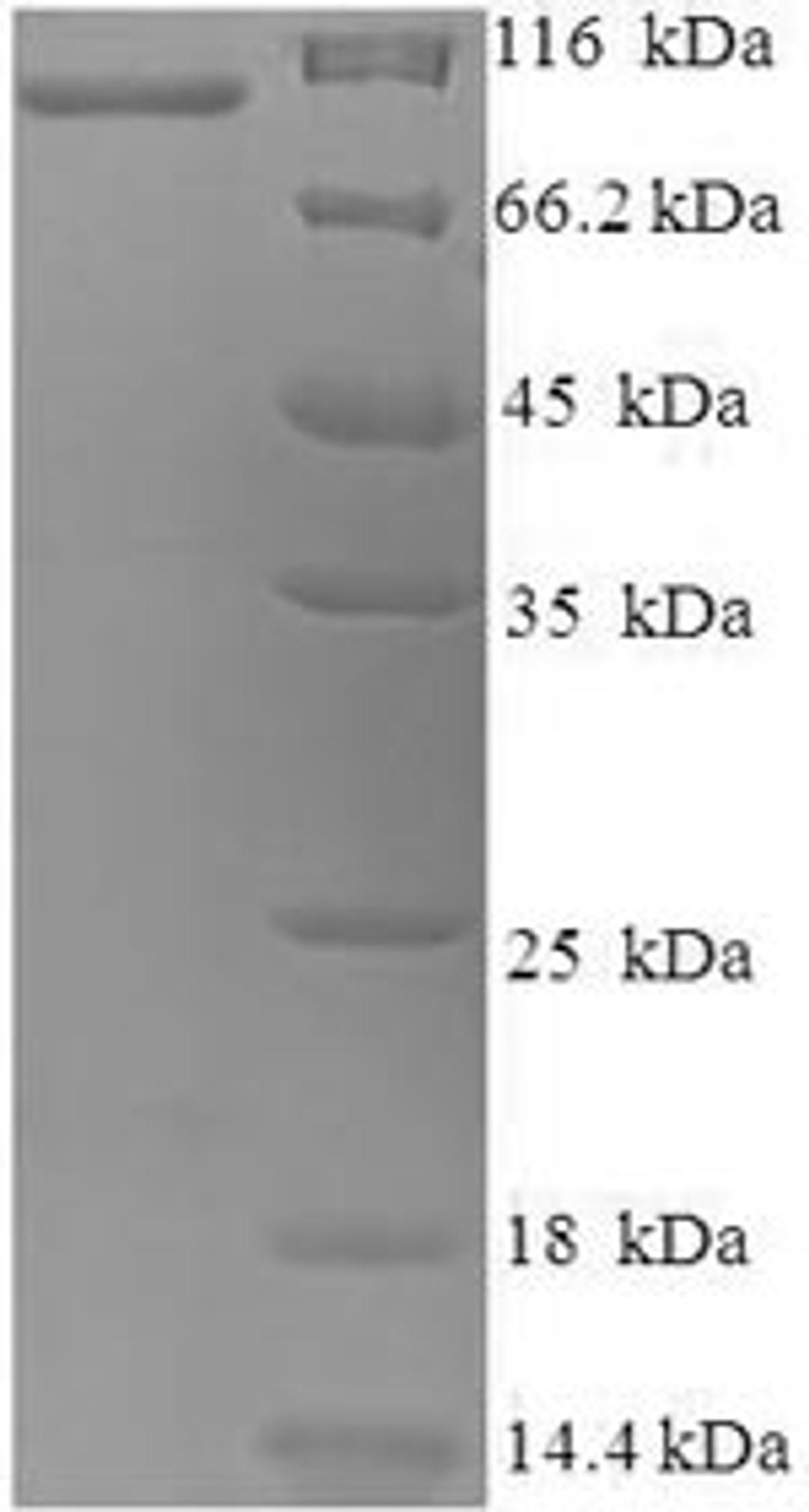 (Tris-Glycine gel) Discontinuous SDS-PAGE (reduced) with 5% enrichment gel and 15% separation gel.