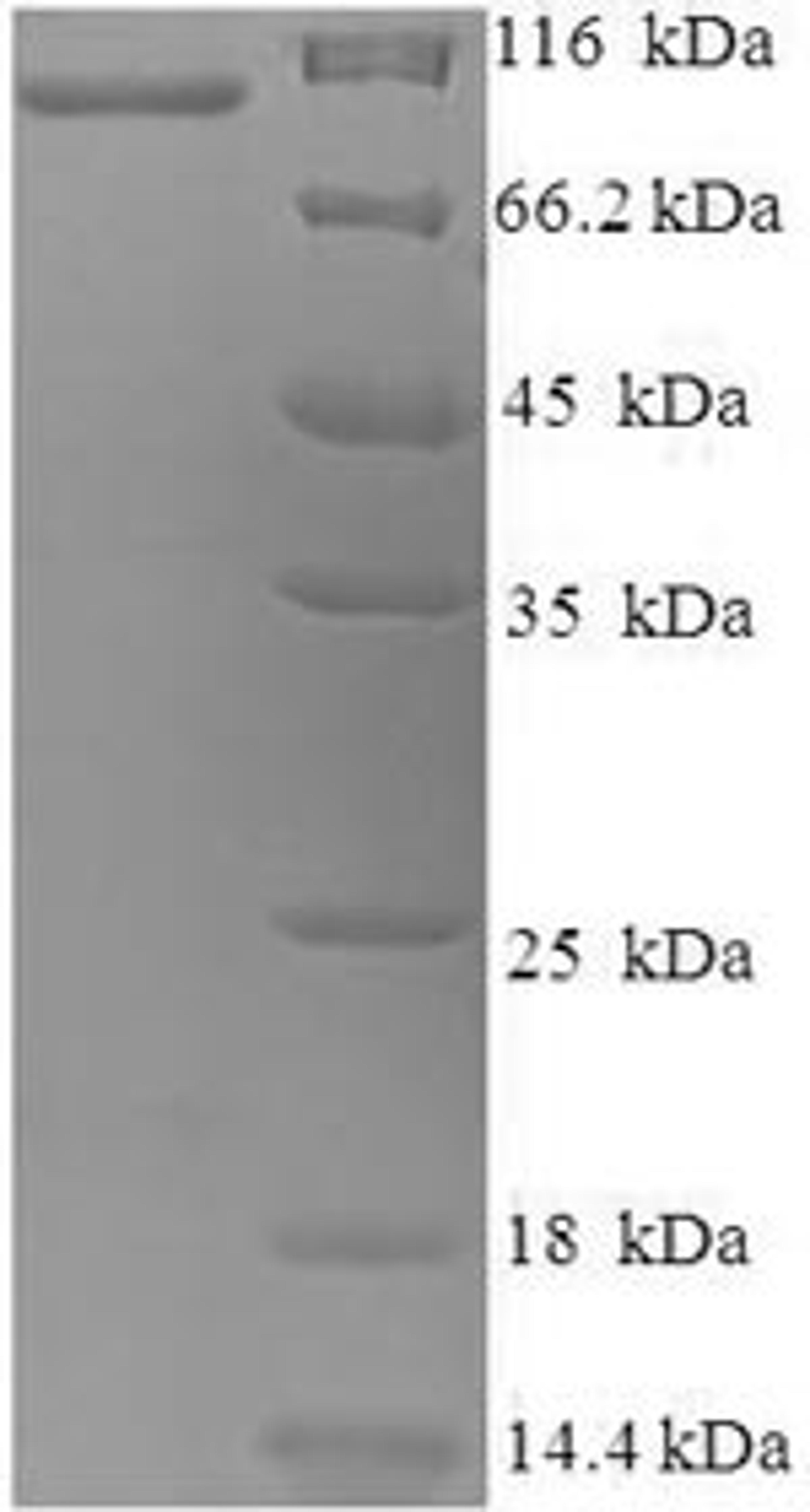 (Tris-Glycine gel) Discontinuous SDS-PAGE (reduced) with 5% enrichment gel and 15% separation gel.