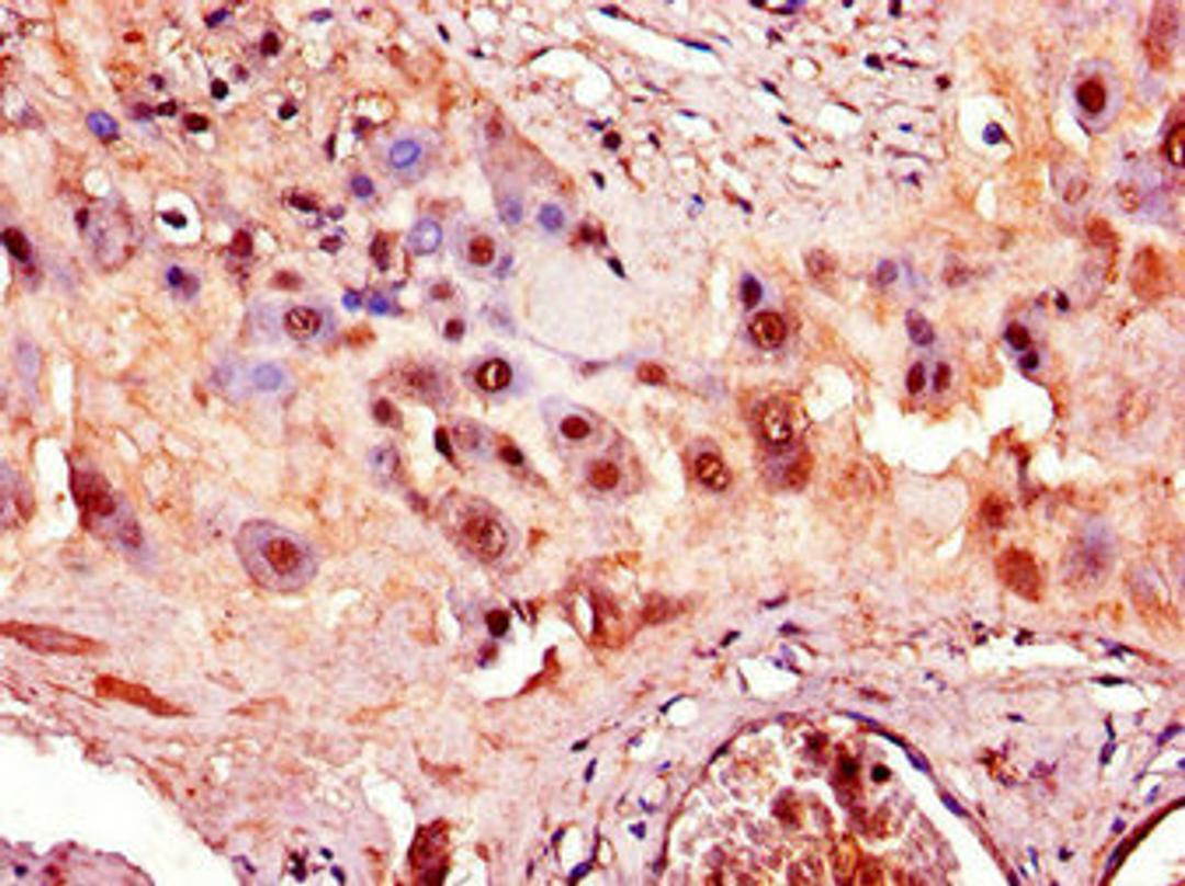 Immunohistochemistry of paraffin-embedded human placenta tissue using CSB-PA001275LA01HU at dilution of 1:100