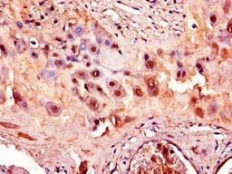 Immunohistochemistry of paraffin-embedded human placenta tissue using CSB-PA001275LA01HU at dilution of 1:100