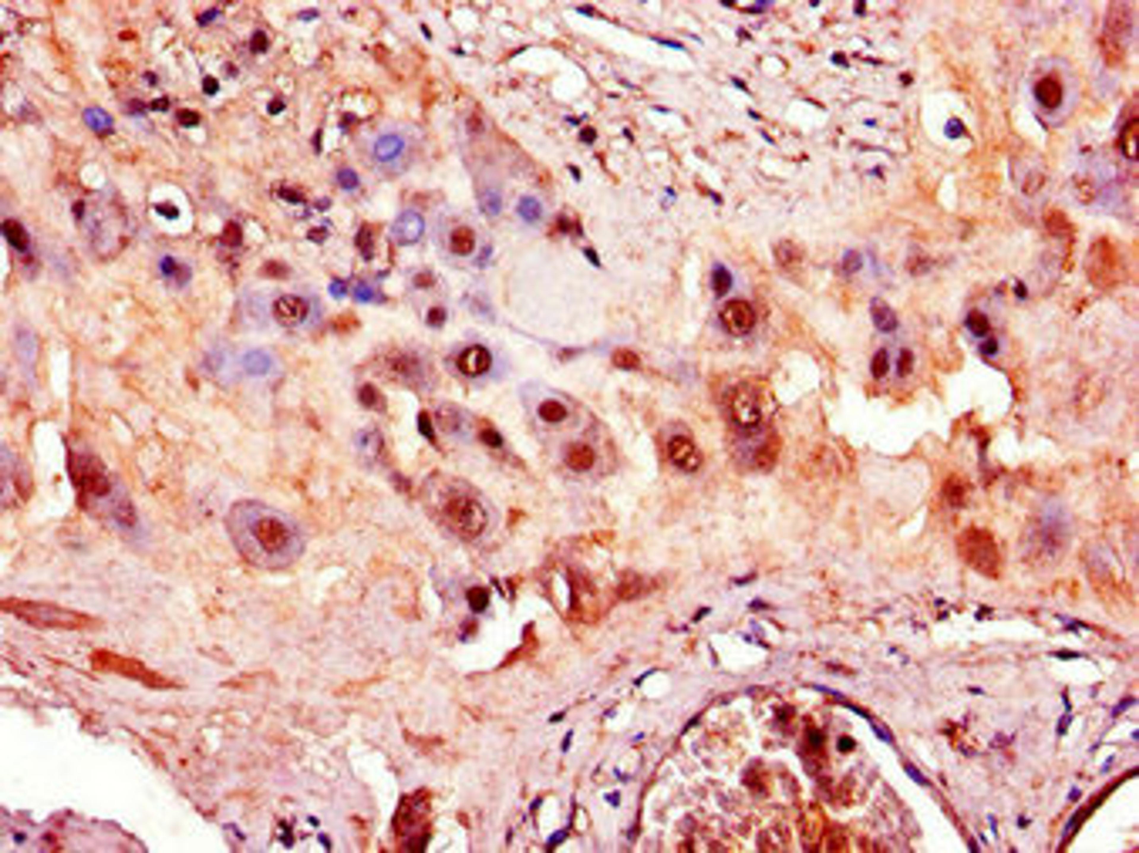 Immunohistochemistry of paraffin-embedded human placenta tissue using CSB-PA001275LA01HU at dilution of 1:100