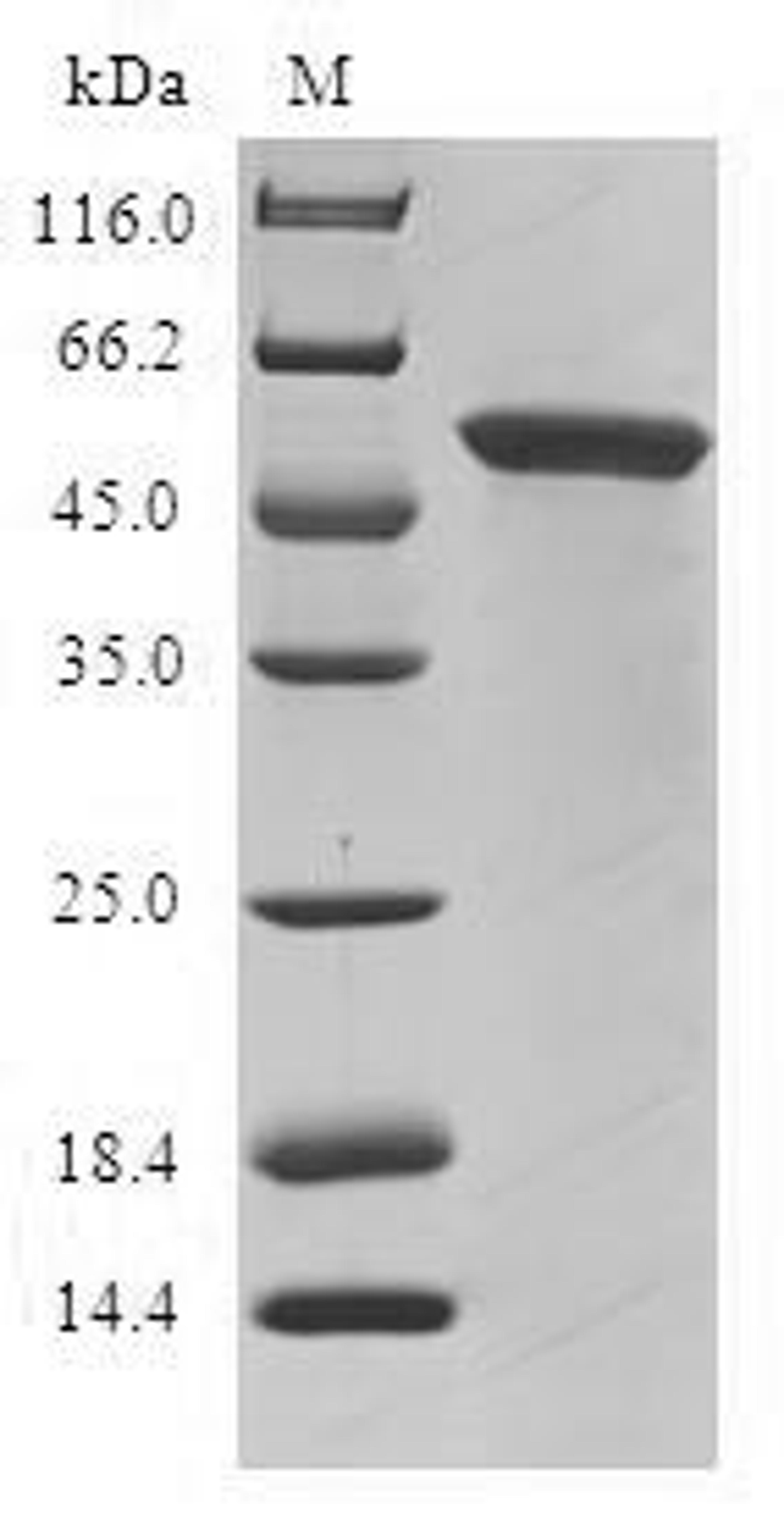 (Tris-Glycine gel) Discontinuous SDS-PAGE (reduced) with 5% enrichment gel and 15% separation gel.