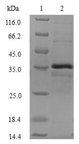 (Tris-Glycine gel) Discontinuous SDS-PAGE (reduced) with 5% enrichment gel and 15% separation gel.