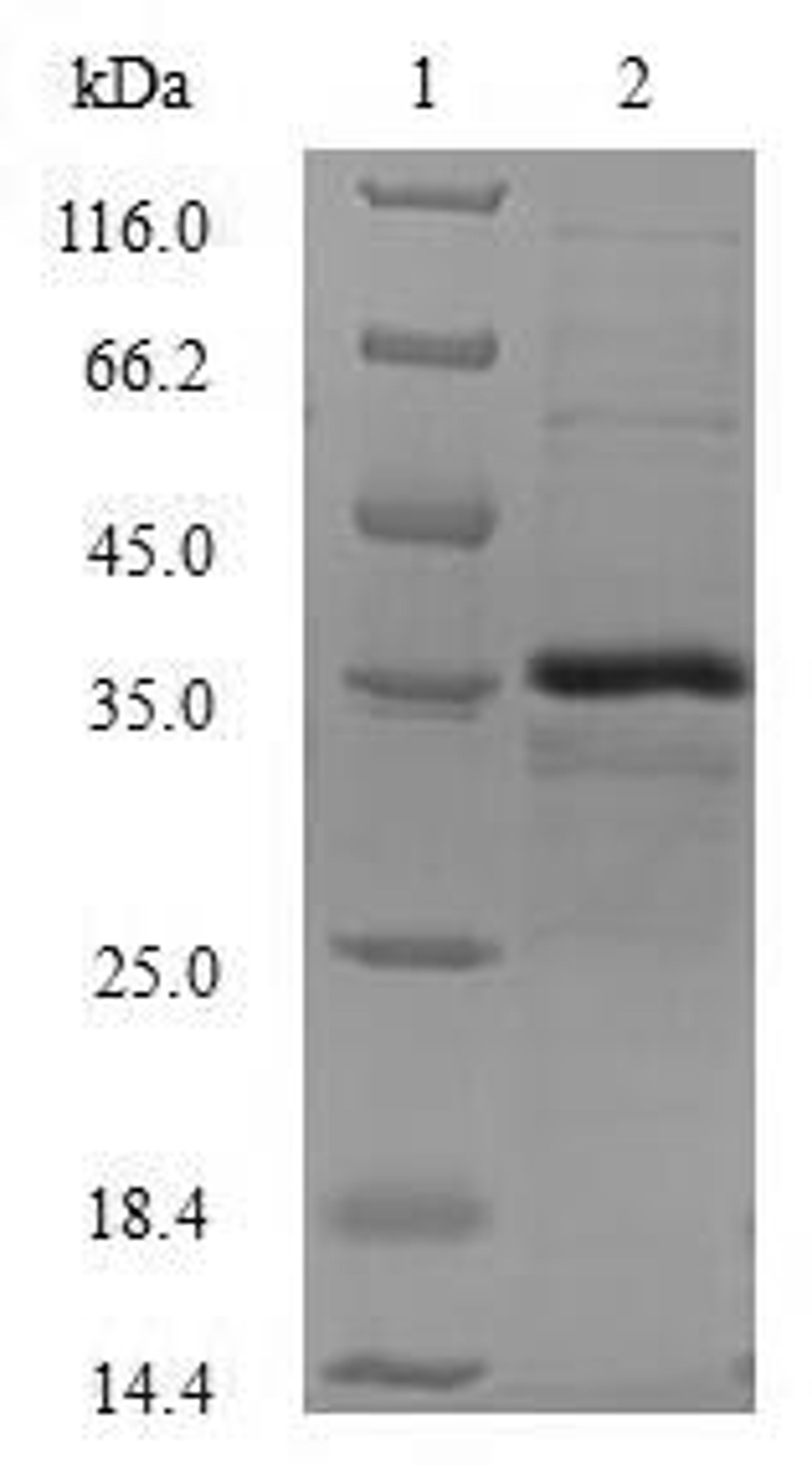 (Tris-Glycine gel) Discontinuous SDS-PAGE (reduced) with 5% enrichment gel and 15% separation gel.