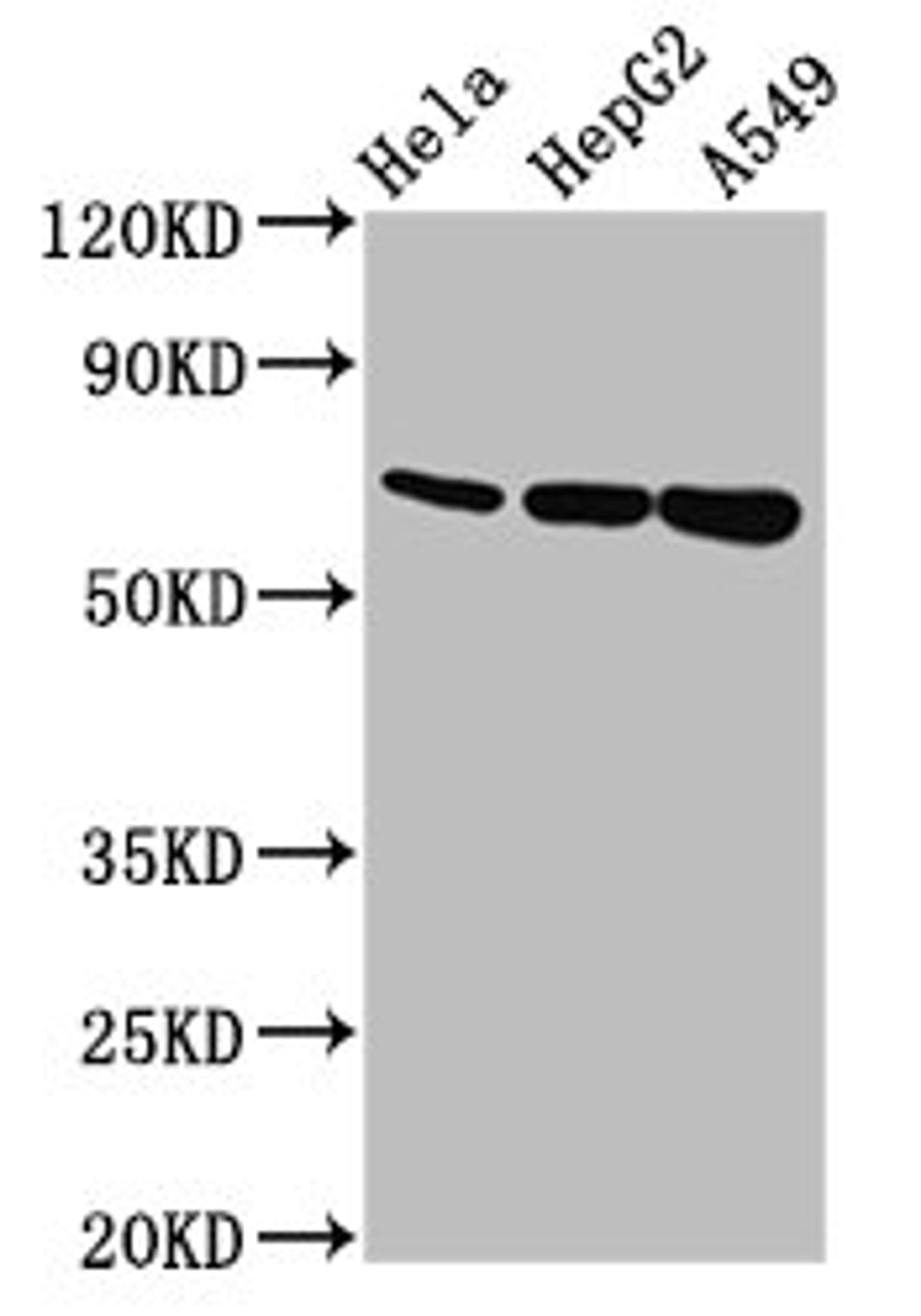 Western Blot. Positive WB detected in: Hela whole cell lysate, HepG2 whole cell lysate, A549 whole cell lysate. All lanes: MUC20 antibody at 5.6µg/ml. Secondary. Goat polyclonal to rabbit IgG at 1/50000 dilution. Predicted band size: 72, 69 kDa. Observed band size: 72 kDa