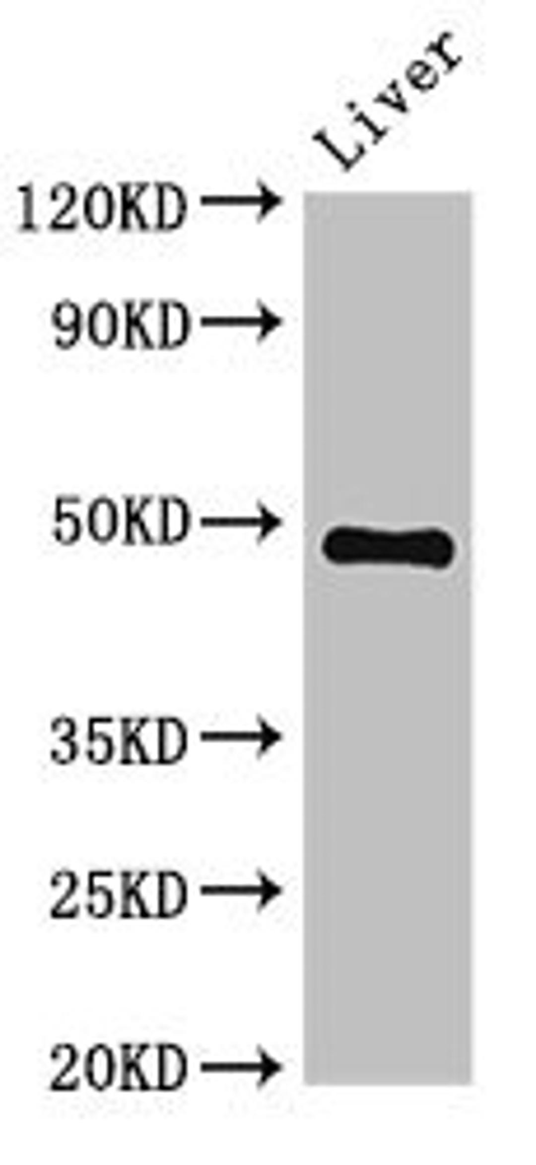 Western Blot. Positive WB detected in: Mouse liver tissue. All lanes: PSMC4 antibody at 3.4ug/ml. Secondary. Goat polyclonal to rabbit IgG at 1/50000 dilution. Predicted band size: 48, 44 kDa. Observed band size: 48 kDa. 