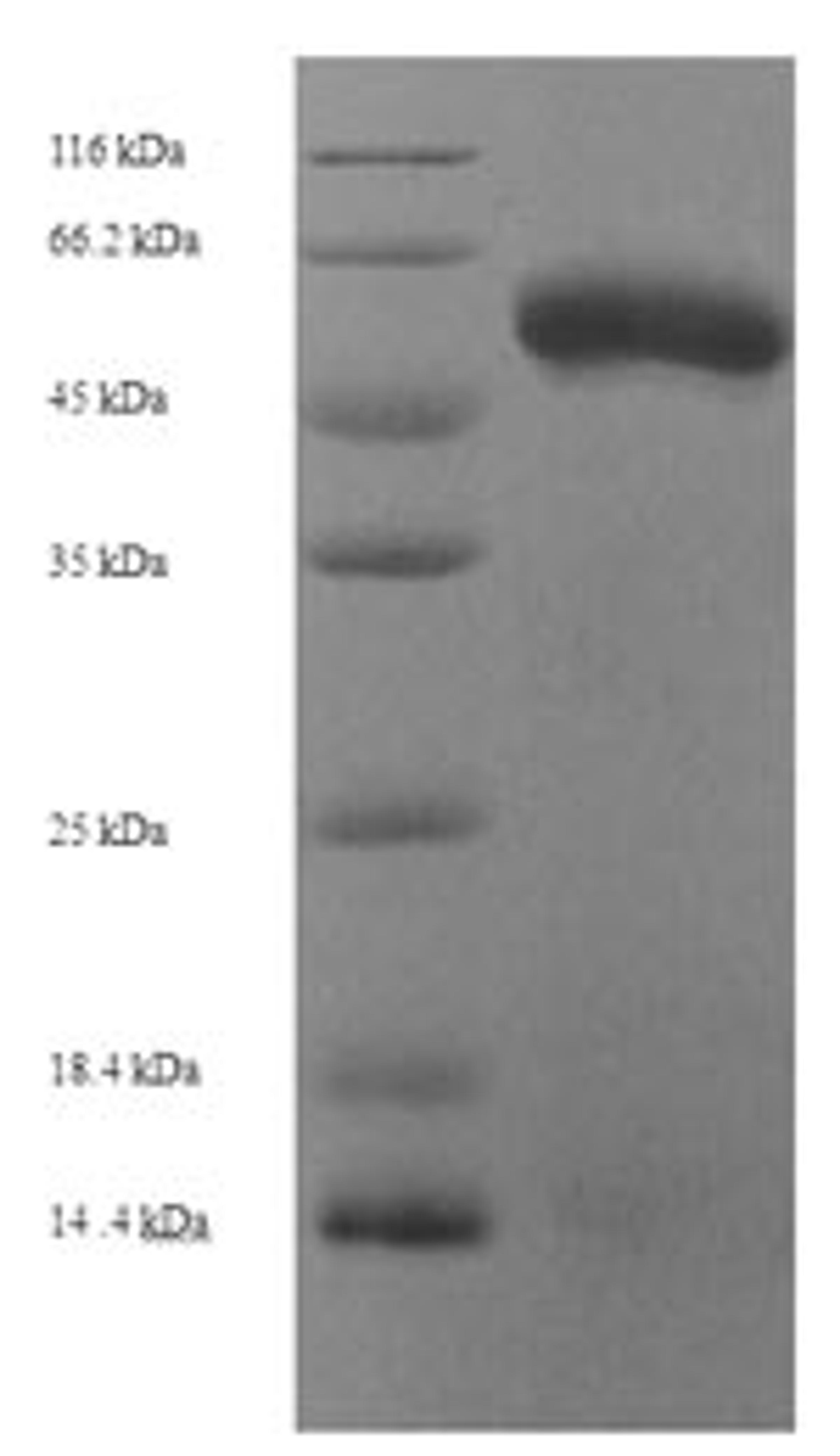 (Tris-Glycine gel) Discontinuous SDS-PAGE (reduced) with 5% enrichment gel and 15% separation gel.