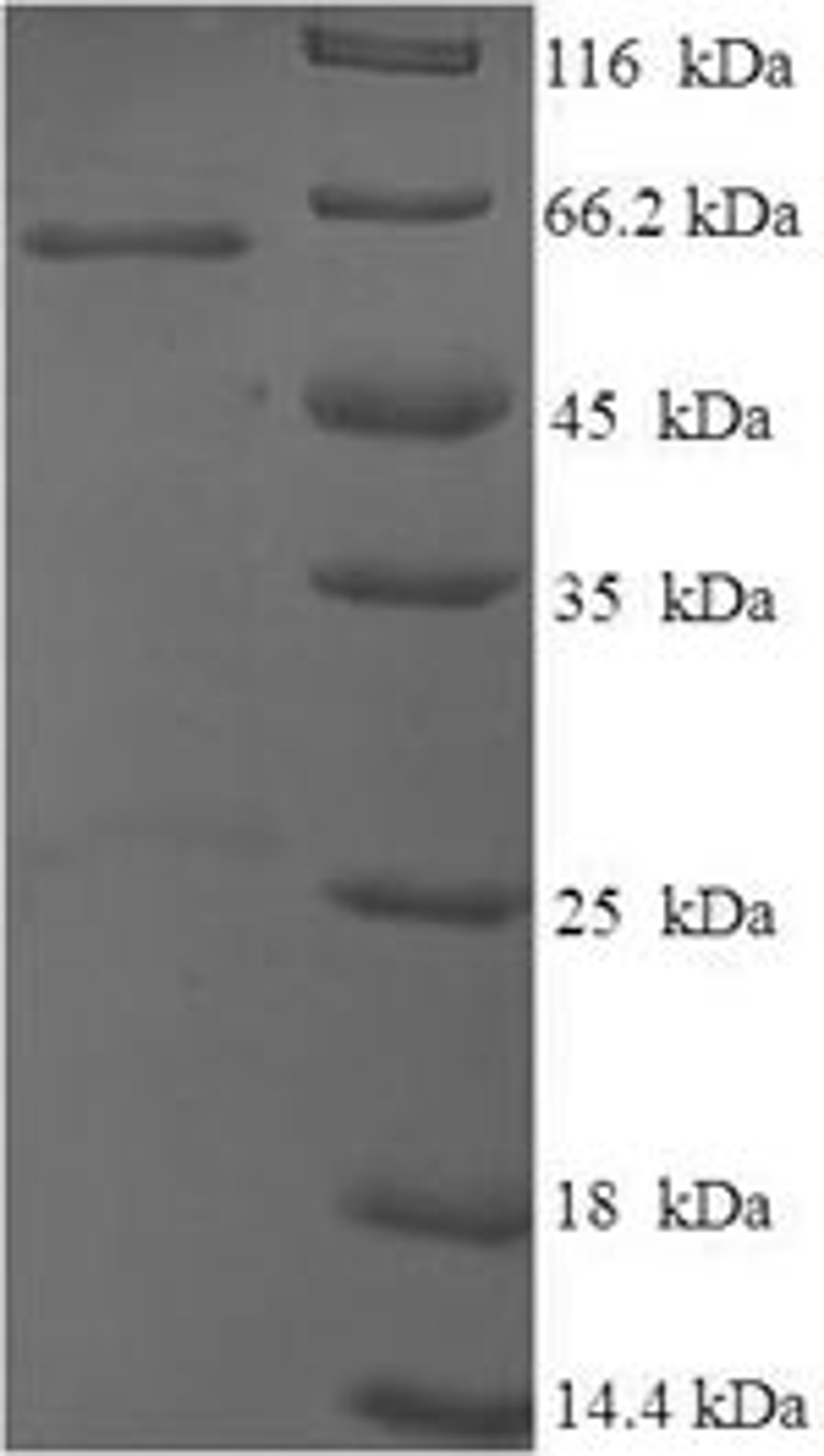 (Tris-Glycine gel) Discontinuous SDS-PAGE (reduced) with 5% enrichment gel and 15% separation gel.