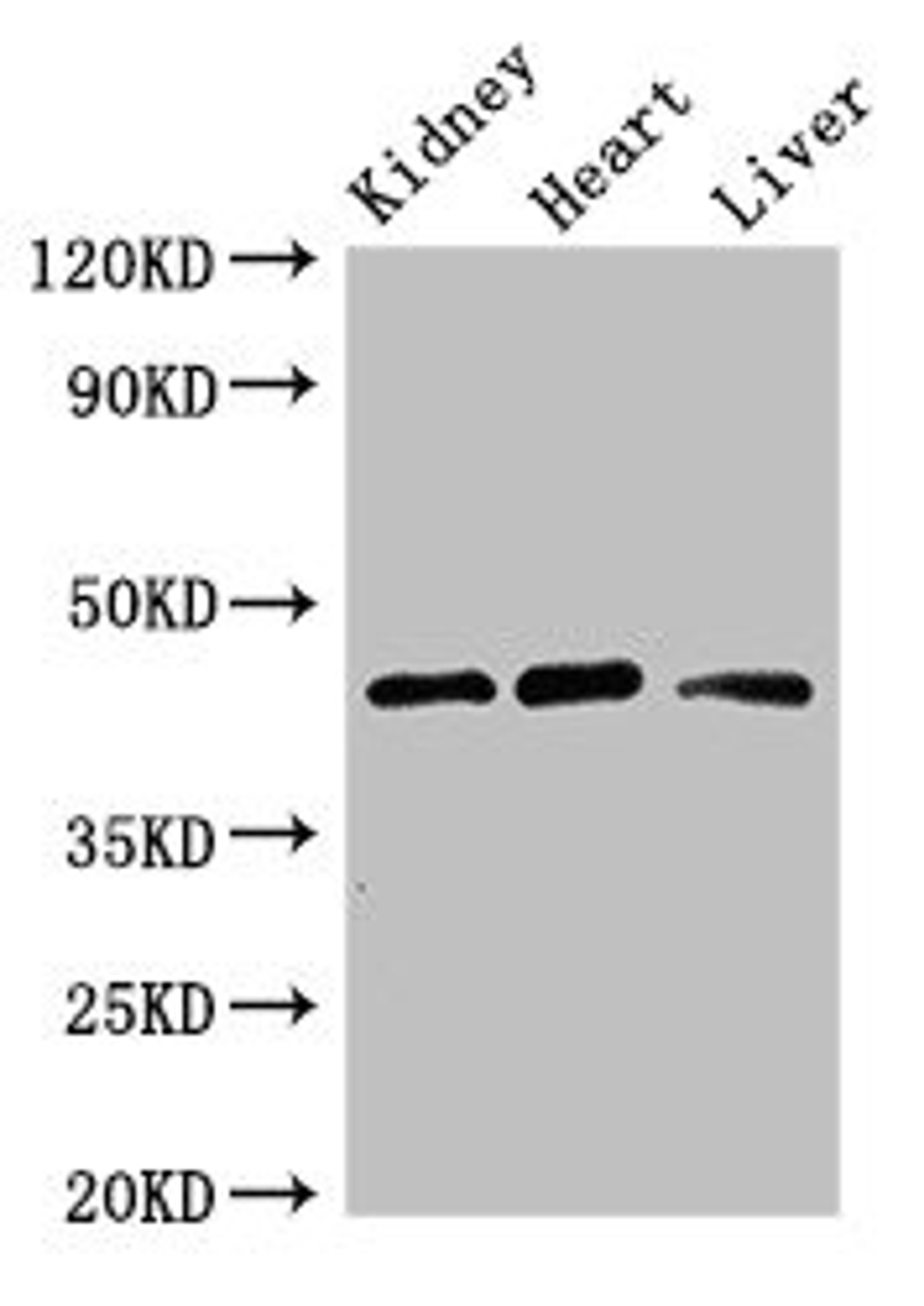 Western Blot. Positive WB detected in: Mouse kidney tissue, Rat heart tissue, Rat liver tissue. All lanes: WTAP antibody at 3ug/ml. Secondary. Goat polyclonal to rabbit IgG at 1/50000 dilution. Predicted band size: 45, 18 kDa. Observed band size: 45 kDa. 