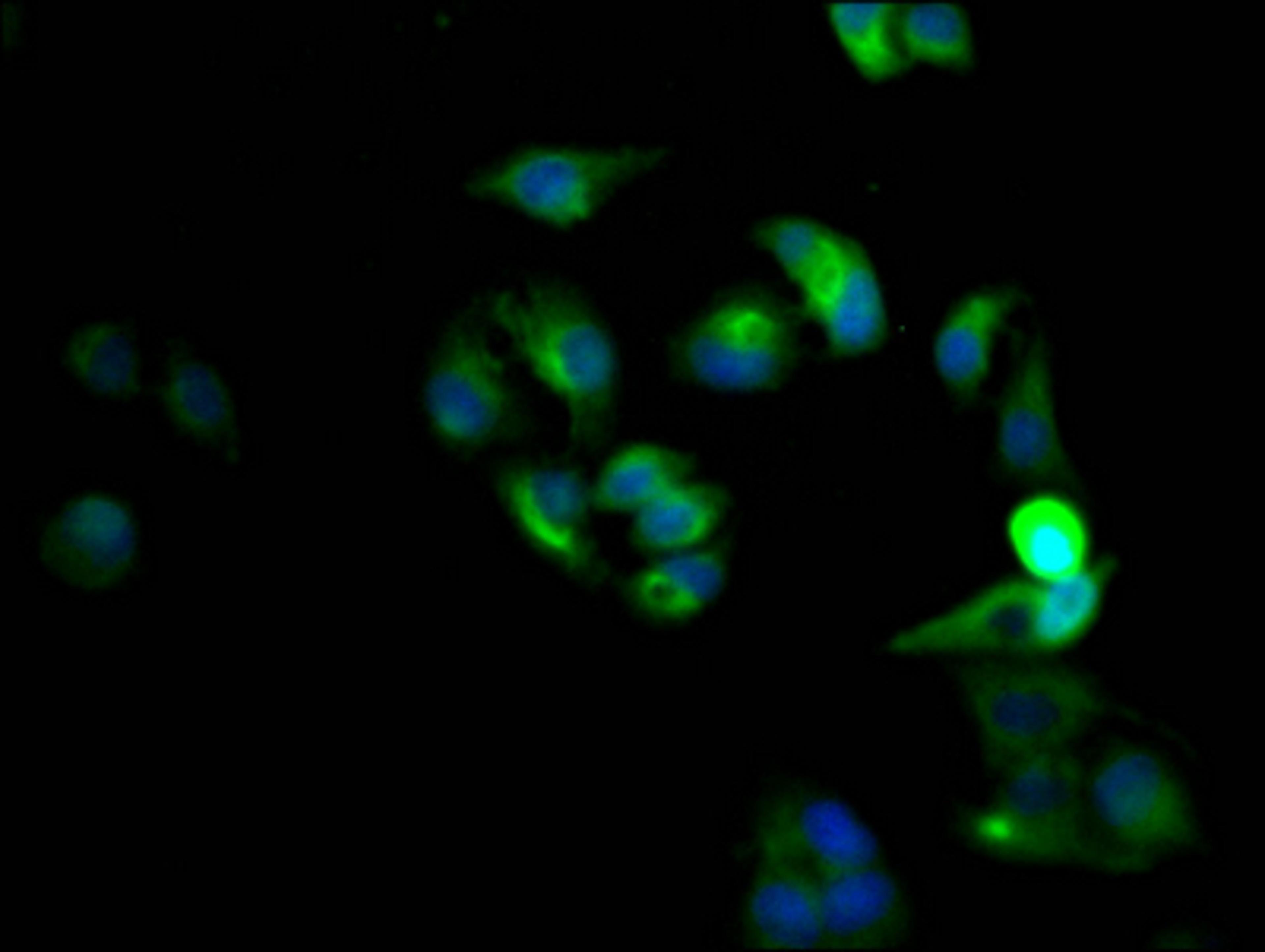 Immunofluorescence staining of Hela Cells with CSB-RA569311A0HU at 1:50, counter-stained with DAPI. The cells were fixed in 4% formaldehyde, permeated by 0.2% TritonX-100, and blocked in 10% normal Goat Serum. The cells were then incubated with the antibody overnight at 4℃. Nuclear DNA was labeled in blue with DAPI. The secondary antibody was FITC-conjugated AffiniPure Goat Anti-Rabbit IgG (H+L).