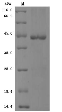 (Tris-Glycine gel) Discontinuous SDS-PAGE (reduced) with 5% enrichment gel and 15% separation gel.