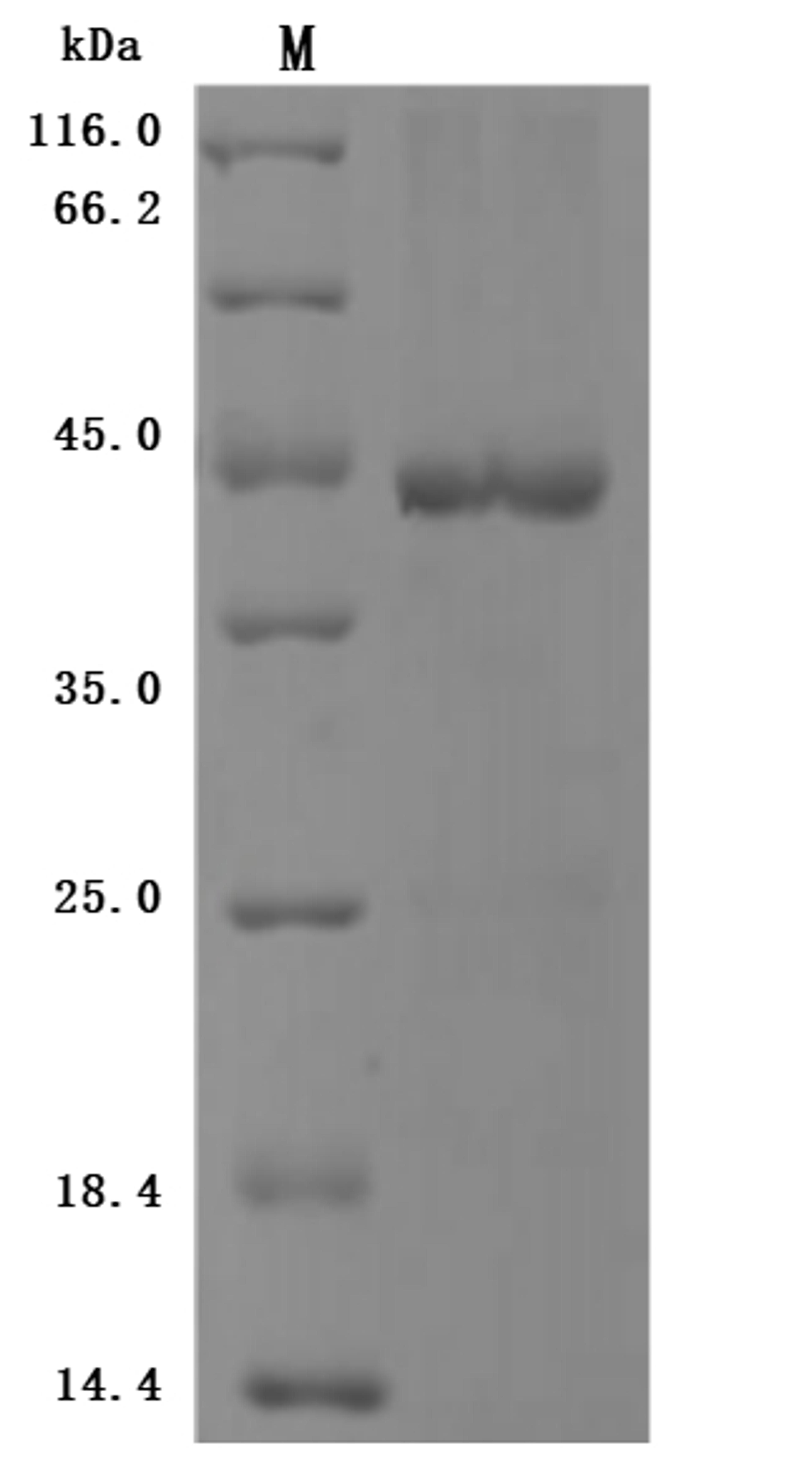 (Tris-Glycine gel) Discontinuous SDS-PAGE (reduced) with 5% enrichment gel and 15% separation gel.
