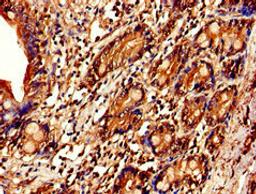 Immunohistochemistry of paraffin-embedded human small intestine tissue using CSB-PA011670EA01HU at dilution of 1:100