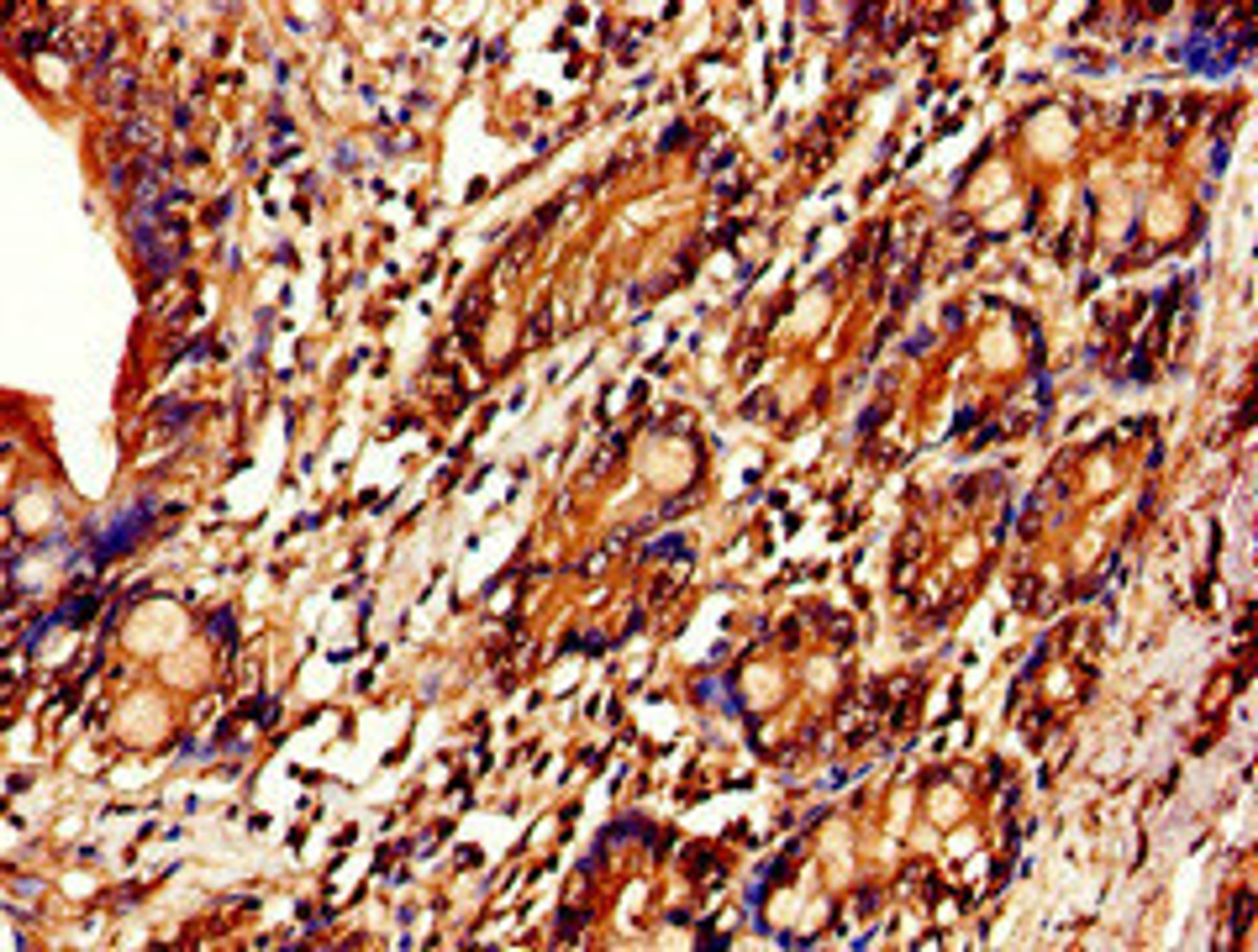 Immunohistochemistry of paraffin-embedded human small intestine tissue using CSB-PA011670EA01HU at dilution of 1:100
