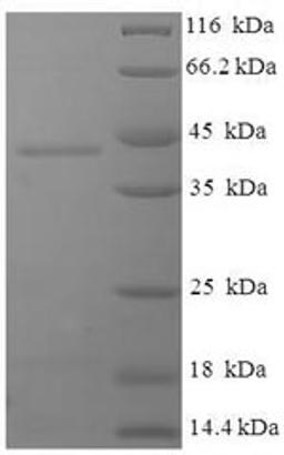 (Tris-Glycine gel) Discontinuous SDS-PAGE (reduced) with 5% enrichment gel and 15% separation gel.