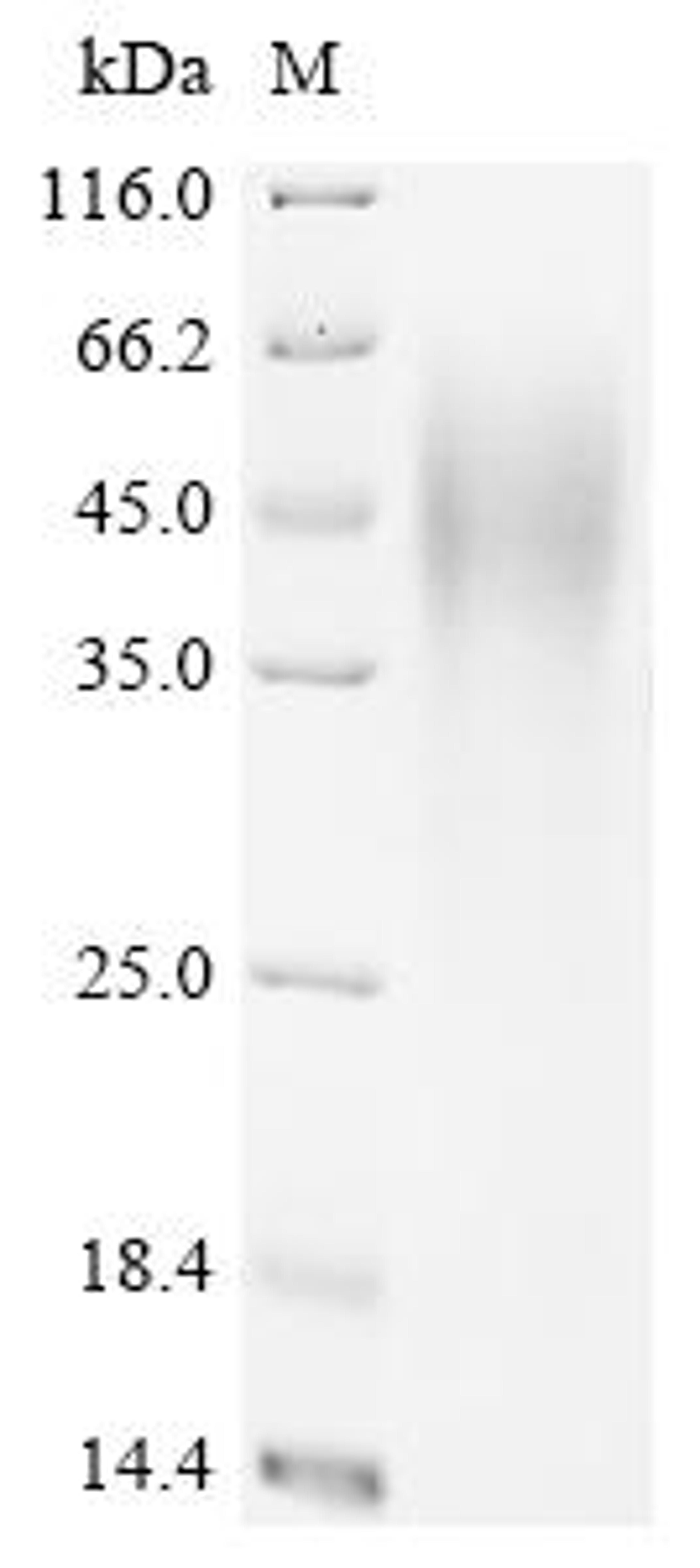 (Tris-Glycine gel) Discontinuous SDS-PAGE (reduced) with 5% enrichment gel and 15% separation gel.