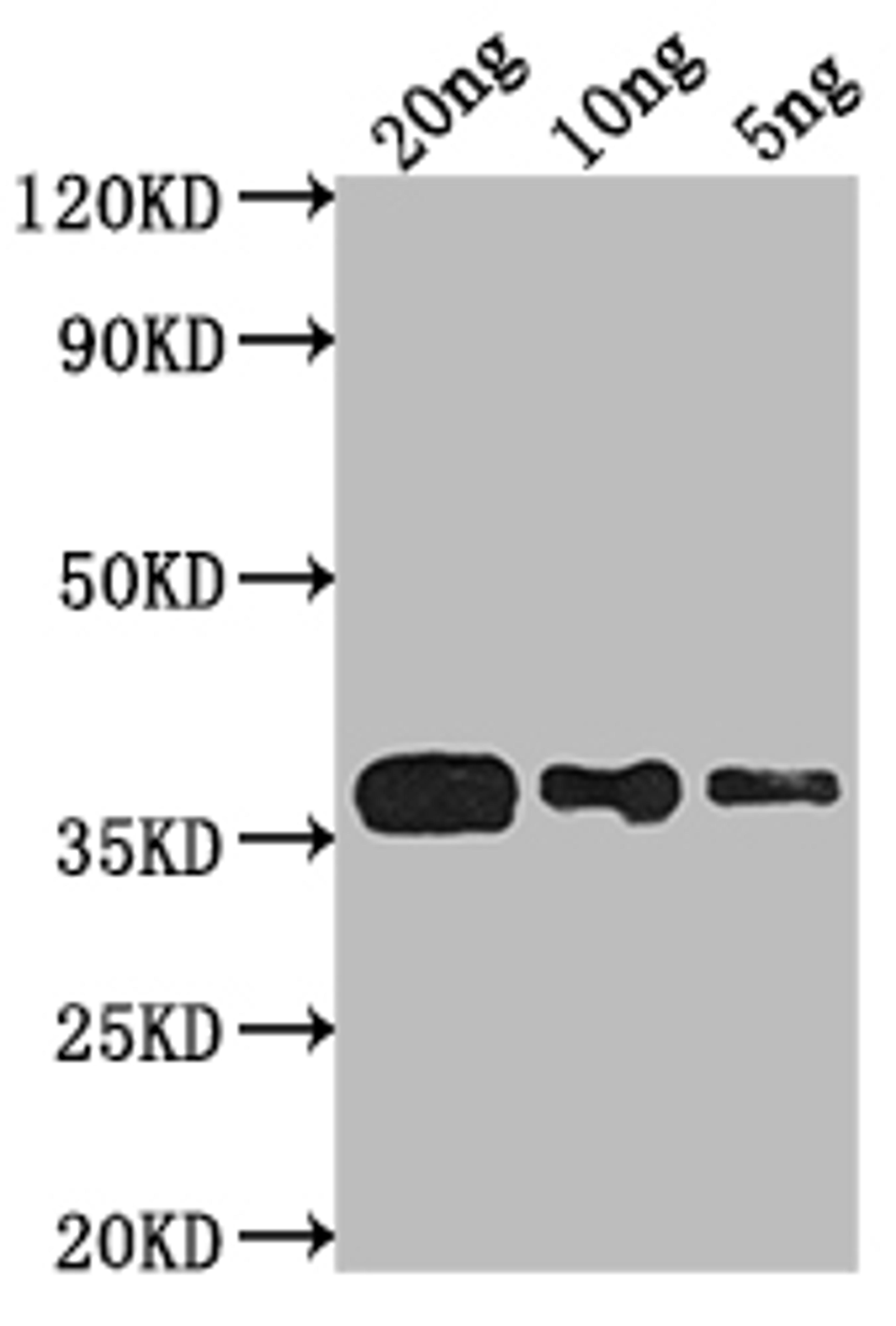 Western Blot. Positive WB detected in Recombinant protein. All lanes: phoP antibody at 1:2000. Secondary. Goat polyclonal to rabbit IgG at 1/50000 dilution. Predicted band size: 30.5 kDa. Observed band size: 37 kDa. 