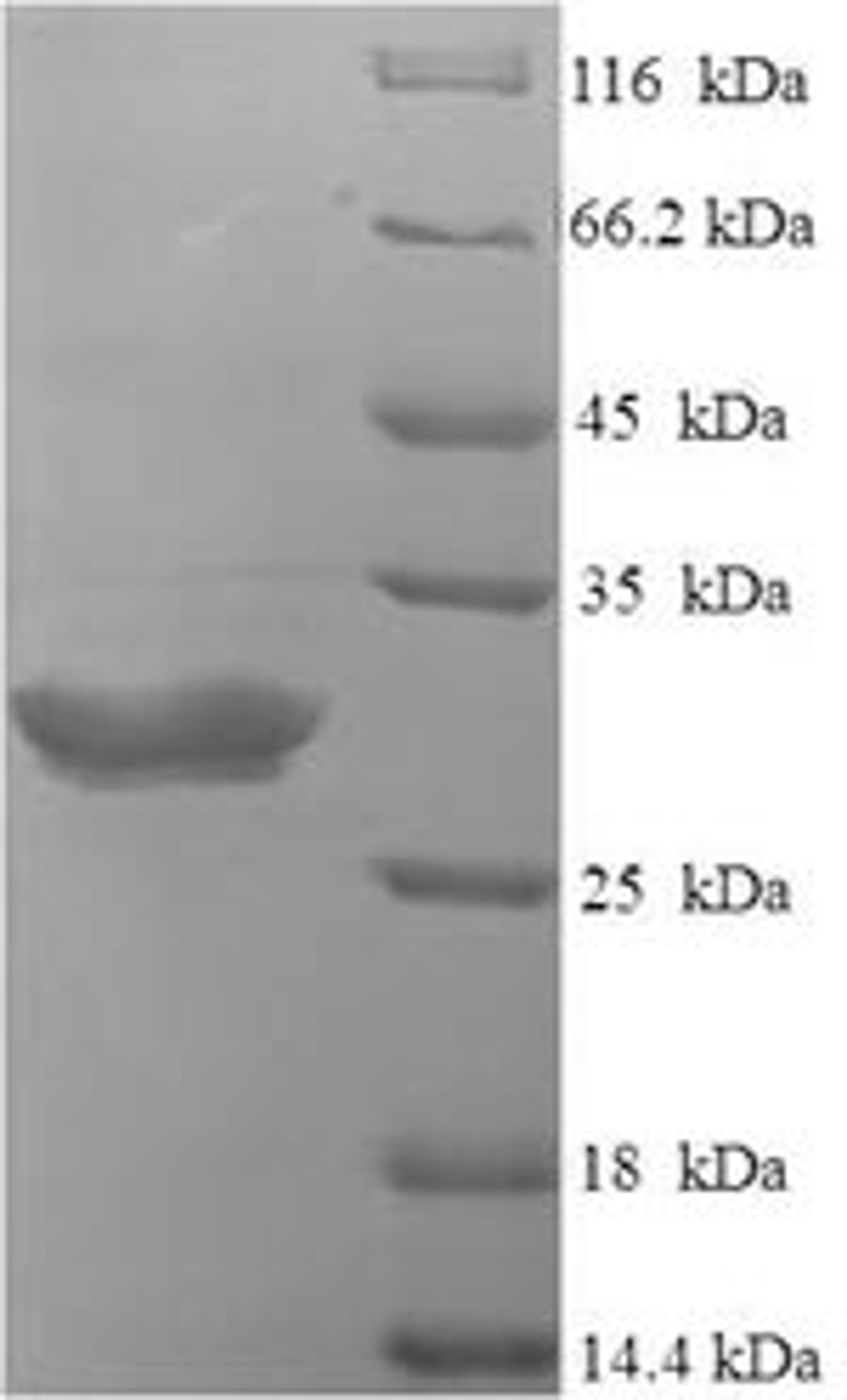 (Tris-Glycine gel) Discontinuous SDS-PAGE (reduced) with 5% enrichment gel and 15% separation gel.
