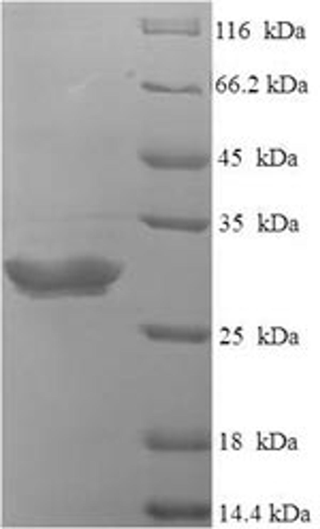(Tris-Glycine gel) Discontinuous SDS-PAGE (reduced) with 5% enrichment gel and 15% separation gel.