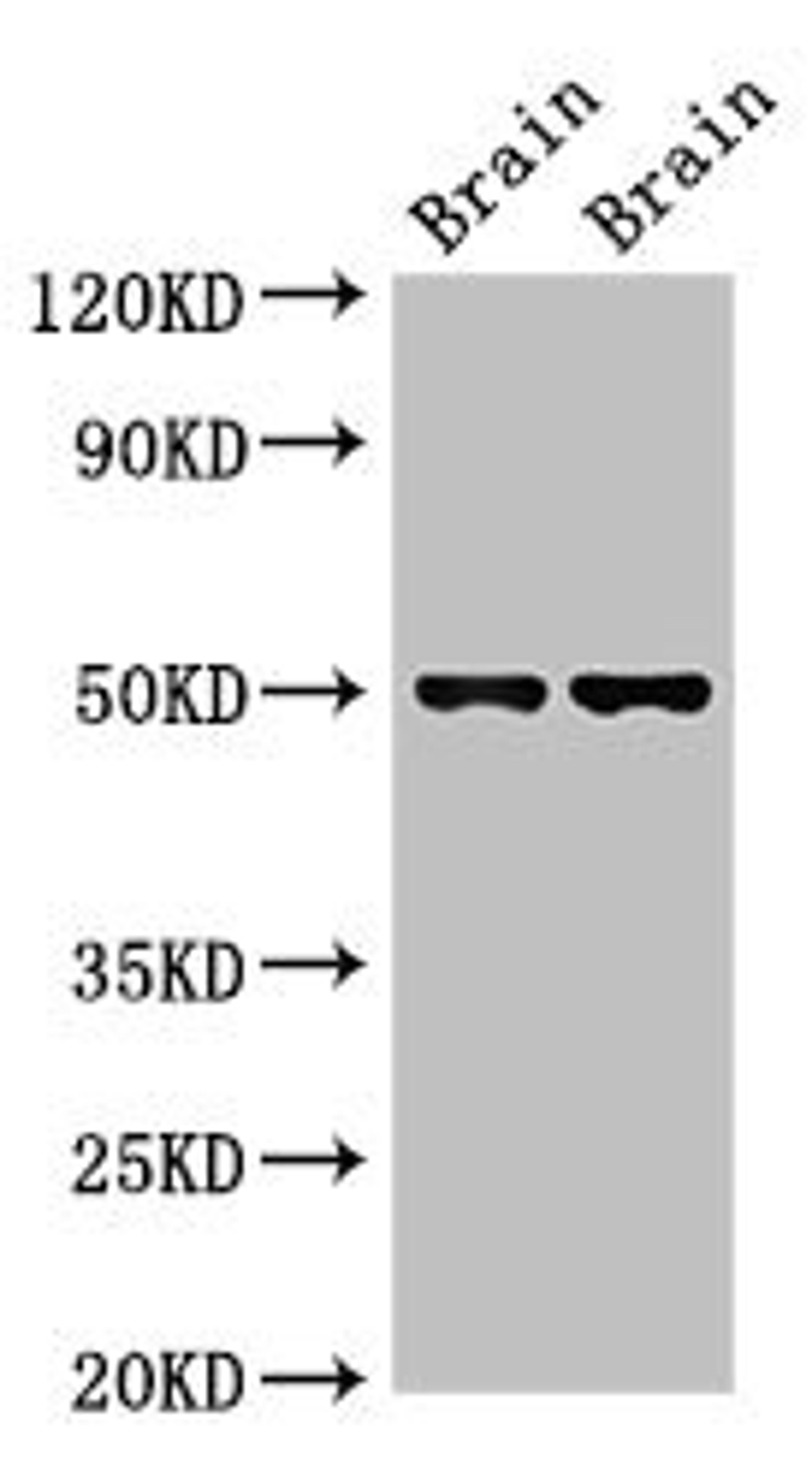 Western Blot. Positive WB detected in: Mouse brain tissue, Rat brain tissue. All lanes: Gfap antibody at 2.7µg/ml. Secondary. Goat polyclonal to rabbit IgG at 1/50000 dilution. Predicted band size: 50, 49 kDa. Observed band size: 50 kDa