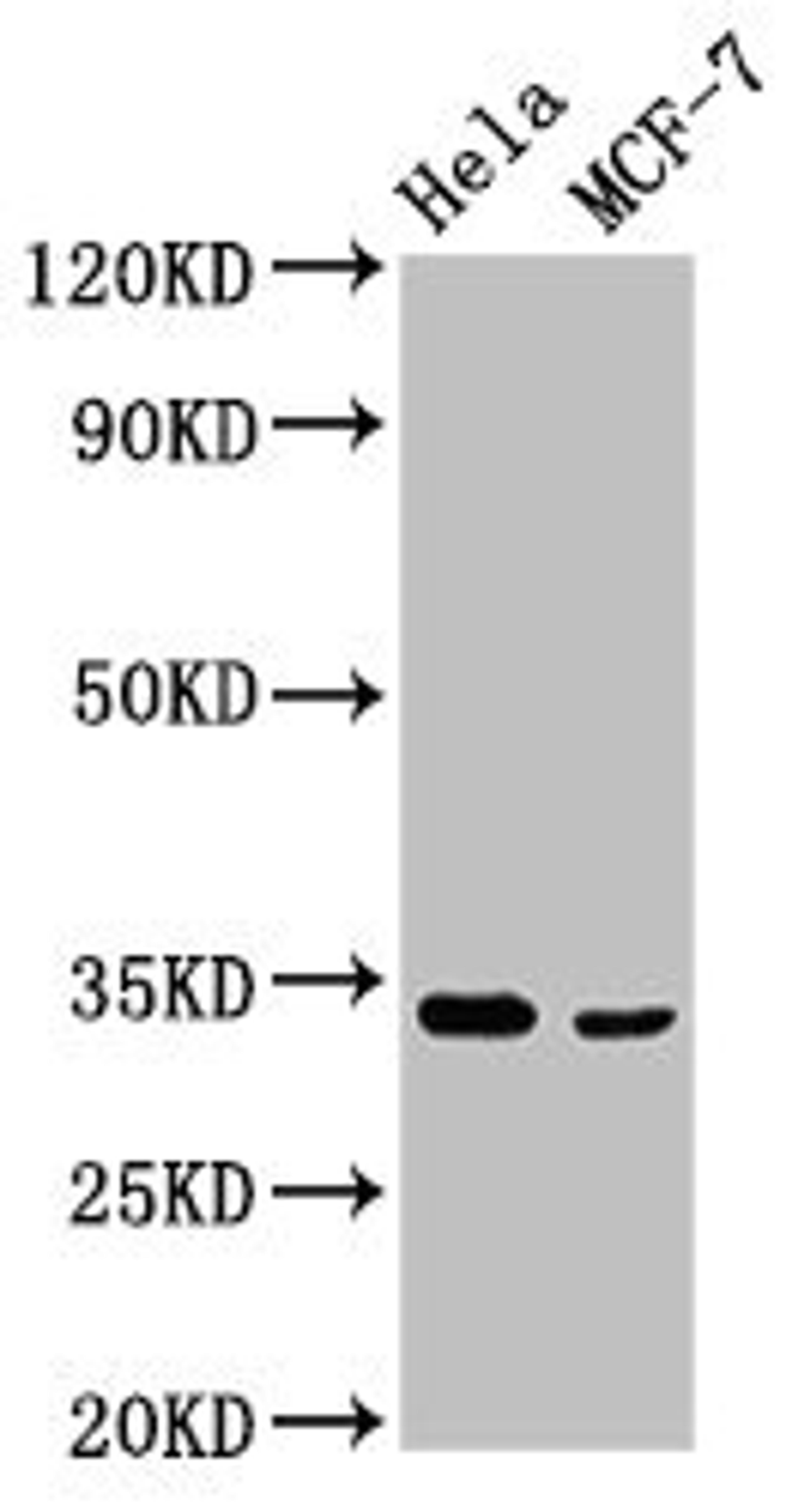 Western Blot. Positive WB detected in: Hela whole cell lysate, MCF-7 whole cell lysate. All lanes: NFKBID antibody at 3.4µg/ml. Secondary. Goat polyclonal to rabbit IgG at 1/50000 dilution. Predicted band size: 34, 51, 16 kDa. Observed band size: 34 kDa