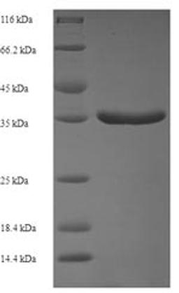 (Tris-Glycine gel) Discontinuous SDS-PAGE (reduced) with 5% enrichment gel and 15% separation gel.