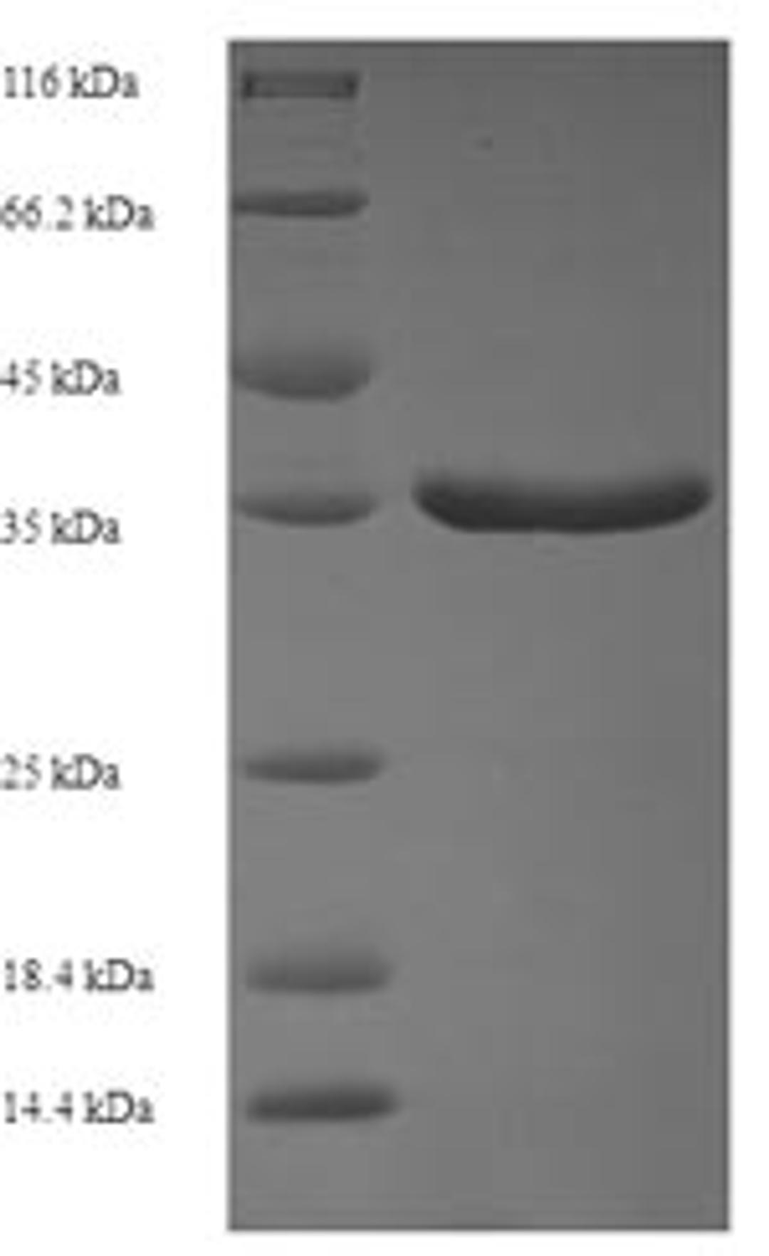(Tris-Glycine gel) Discontinuous SDS-PAGE (reduced) with 5% enrichment gel and 15% separation gel.