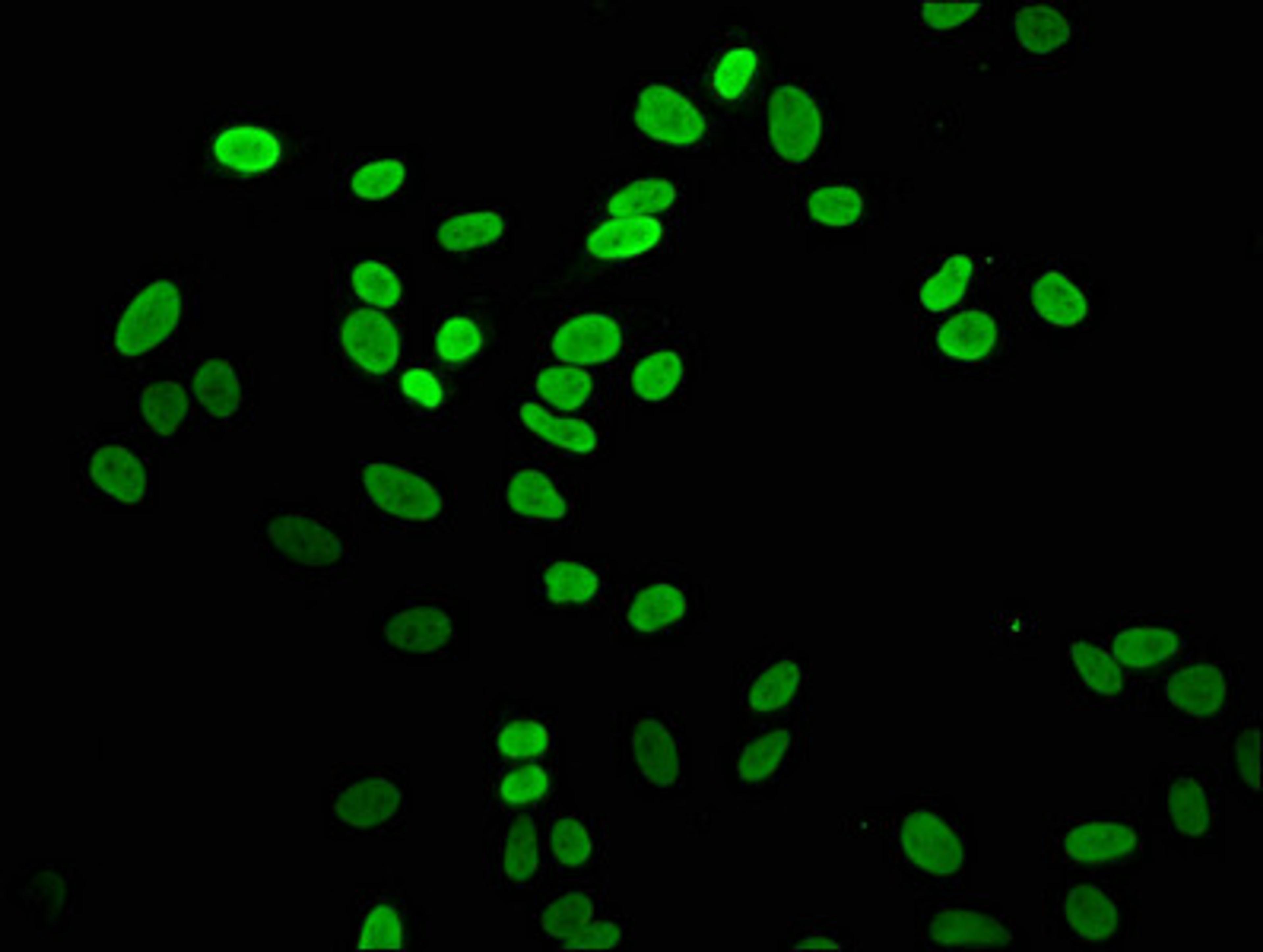 Immunofluorescence staining of Hela cells with CSB-PA010100OA04me1HU at 1:5, counter-stained with DAPI. The cells were fixed in 4% formaldehyde, permeabilized using 0.2% Triton X-100 and blocked in 10% normal Goat Serum. The cells were then incubated with the antibody overnight at 4°C. The secondary antibody was Alexa Fluor 488-congugated AffiniPure Goat Anti-Rabbit IgG(H+L).