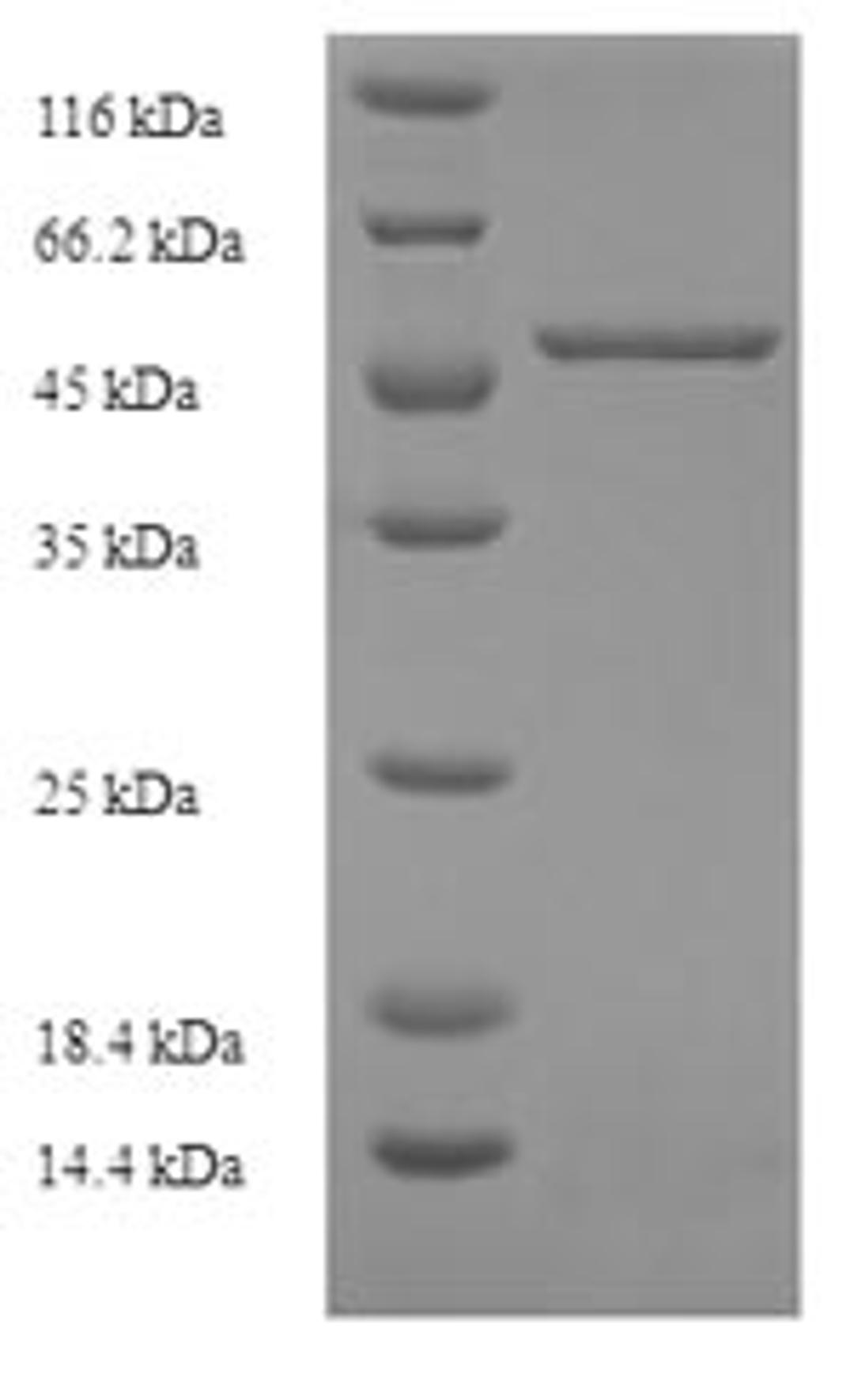 (Tris-Glycine gel) Discontinuous SDS-PAGE (reduced) with 5% enrichment gel and 15% separation gel.