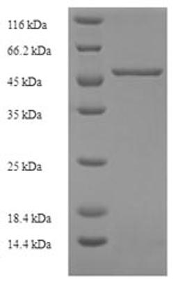 (Tris-Glycine gel) Discontinuous SDS-PAGE (reduced) with 5% enrichment gel and 15% separation gel.