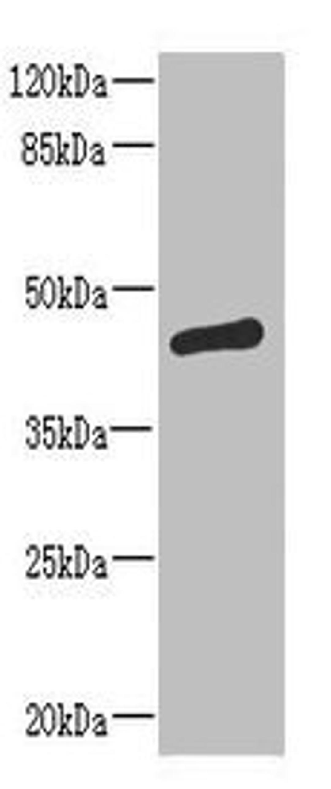 Western blot. All lanes: ST6GALNAC2 antibody at 8ug/ml + MCF-7 whole cell lysate. Secondary. Goat polyclonal to rabbit IgG at 1/10000 dilution. Predicted band size: 42 kDa. Observed band size: 42 kDa. 