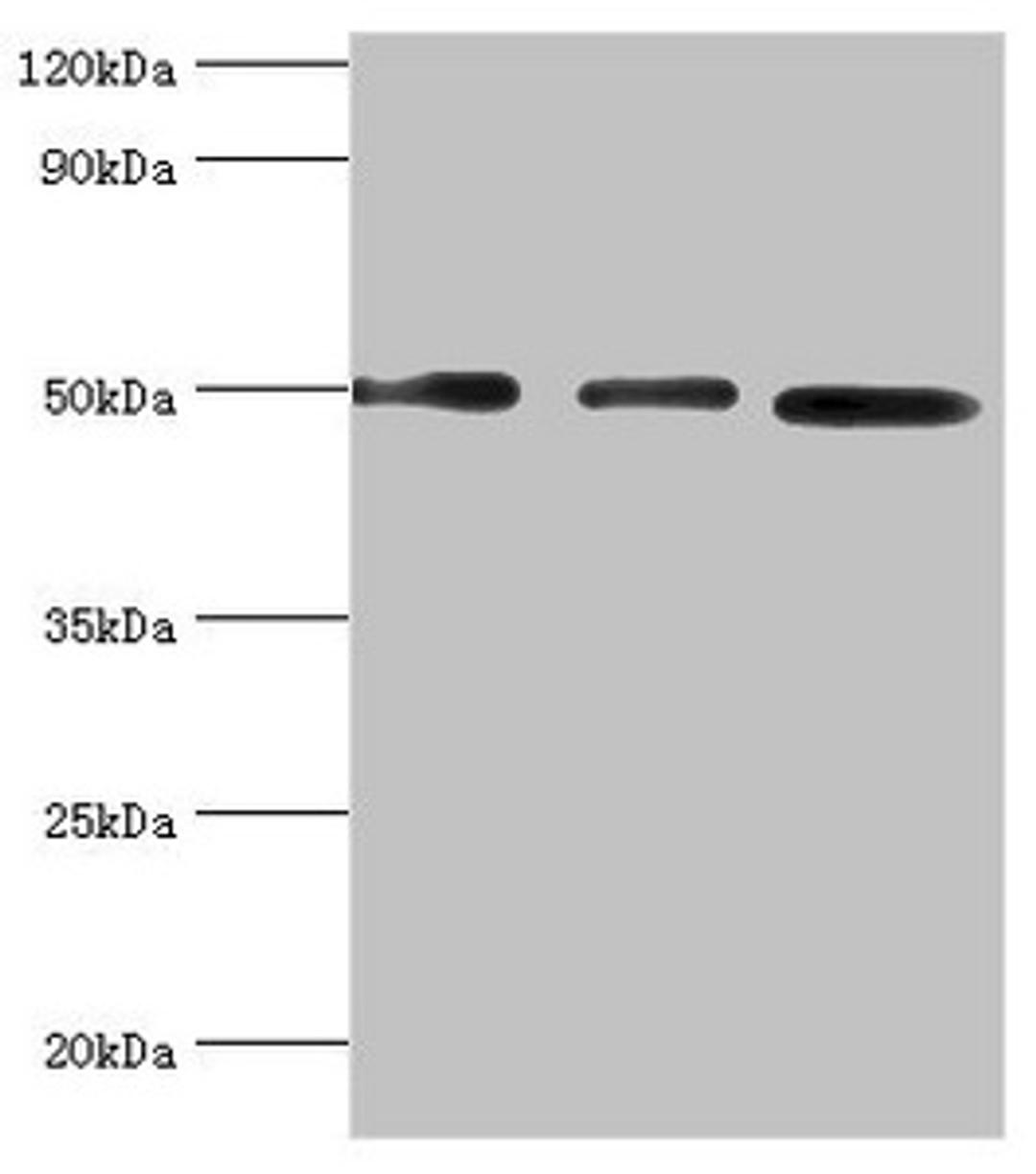 Western blot. All lanes: Adenylosuccinate synthetase isozyme 2 antibody at 12ug/ml. Lane 1: Mouse skeletal muscle tissue. Lane 2: HepG2 whole cell lysate. Lane 3: K562 whole cell lysate. Secondary. Goat polyclonal to rabbit IgG at 1/10000 dilution. Predicted band size: 50 kDa. Observed band size: 50 kDa. 