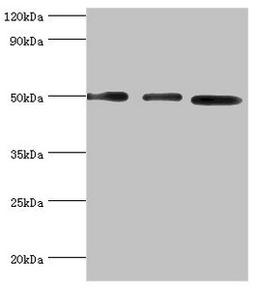 Western blot. All lanes: Adenylosuccinate synthetase isozyme 2 antibody at 12ug/ml. Lane 1: Mouse skeletal muscle tissue. Lane 2: HepG2 whole cell lysate. Lane 3: K562 whole cell lysate. Secondary. Goat polyclonal to rabbit IgG at 1/10000 dilution. Predicted band size: 50 kDa. Observed band size: 50 kDa. 
