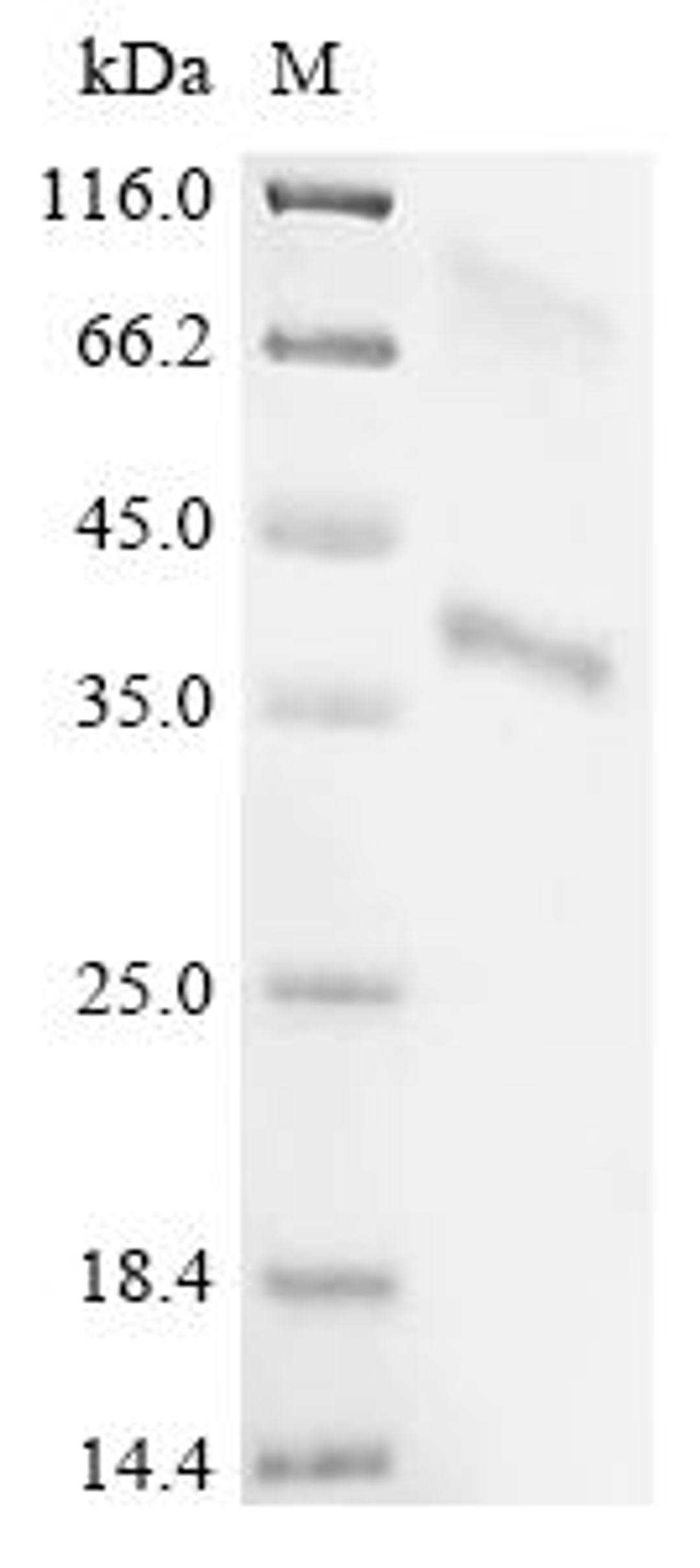 (Tris-Glycine gel) Discontinuous SDS-PAGE (reduced) with 5% enrichment gel and 15% separation gel.