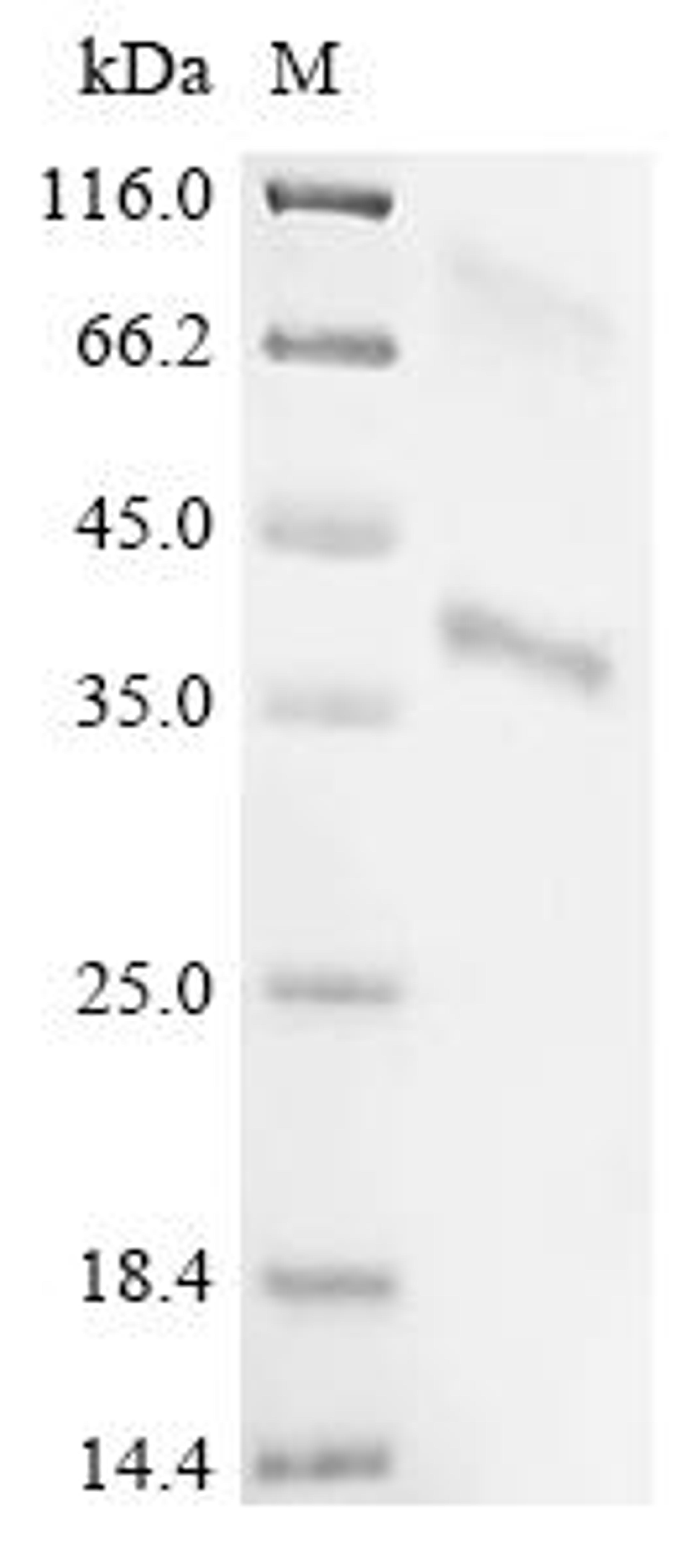 (Tris-Glycine gel) Discontinuous SDS-PAGE (reduced) with 5% enrichment gel and 15% separation gel.