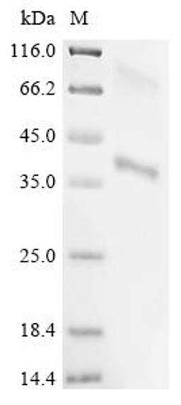 (Tris-Glycine gel) Discontinuous SDS-PAGE (reduced) with 5% enrichment gel and 15% separation gel.