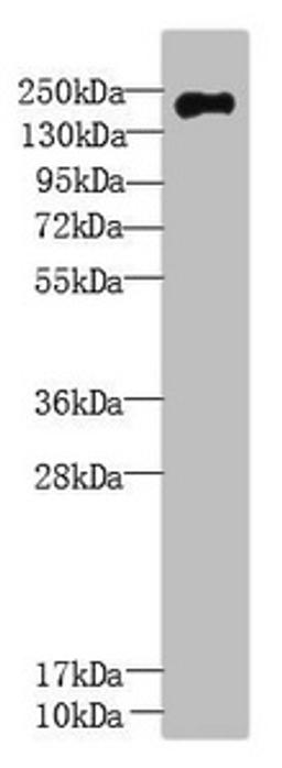 Western Blot. All lanes: UBR2 antibody at 3µg/ml + Mouse liver tissue. Secondary. Goat polyclonal to rabbit IgG at 1/10000 dilution. Predicted band size: 201, 50, 67 kDa. Observed band size: 201 kDa