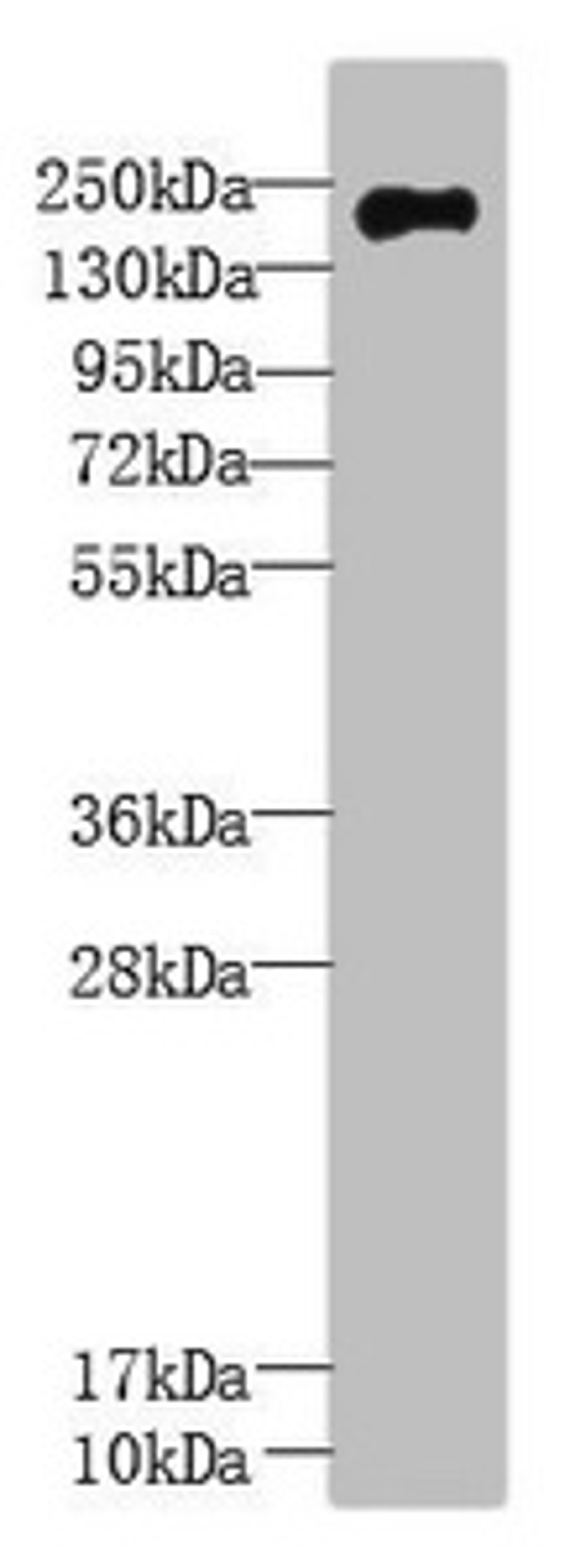 Western Blot. All lanes: UBR2 antibody at 3µg/ml + Mouse liver tissue. Secondary. Goat polyclonal to rabbit IgG at 1/10000 dilution. Predicted band size: 201, 50, 67 kDa. Observed band size: 201 kDa
