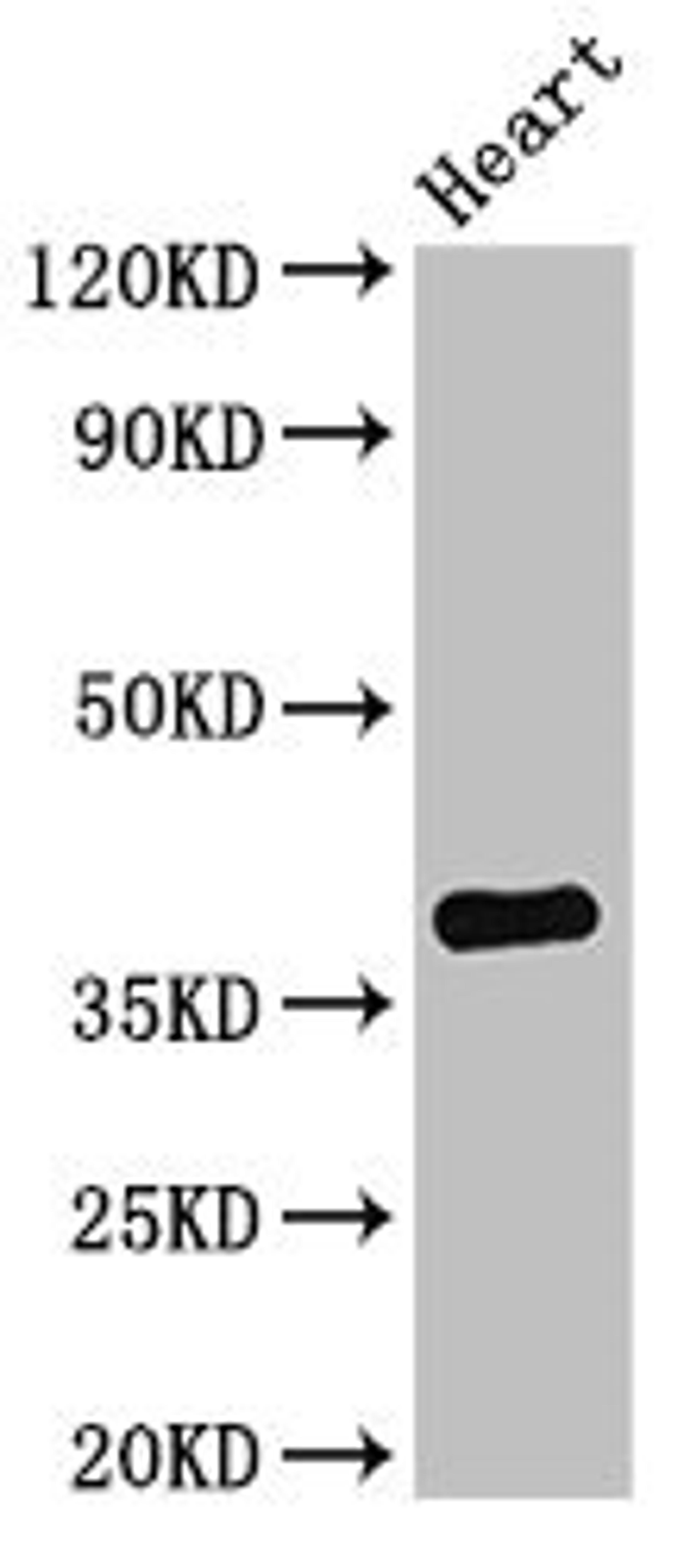 Western Blot. Positive WB detected in: Mouse heart tissue. All lanes: TNMD antibody at 2.8ug/ml. Secondary. Goat polyclonal to rabbit IgG at 1/50000 dilution. Predicted band size: 38, 24, 31 kDa. Observed band size: 38 kDa. 
