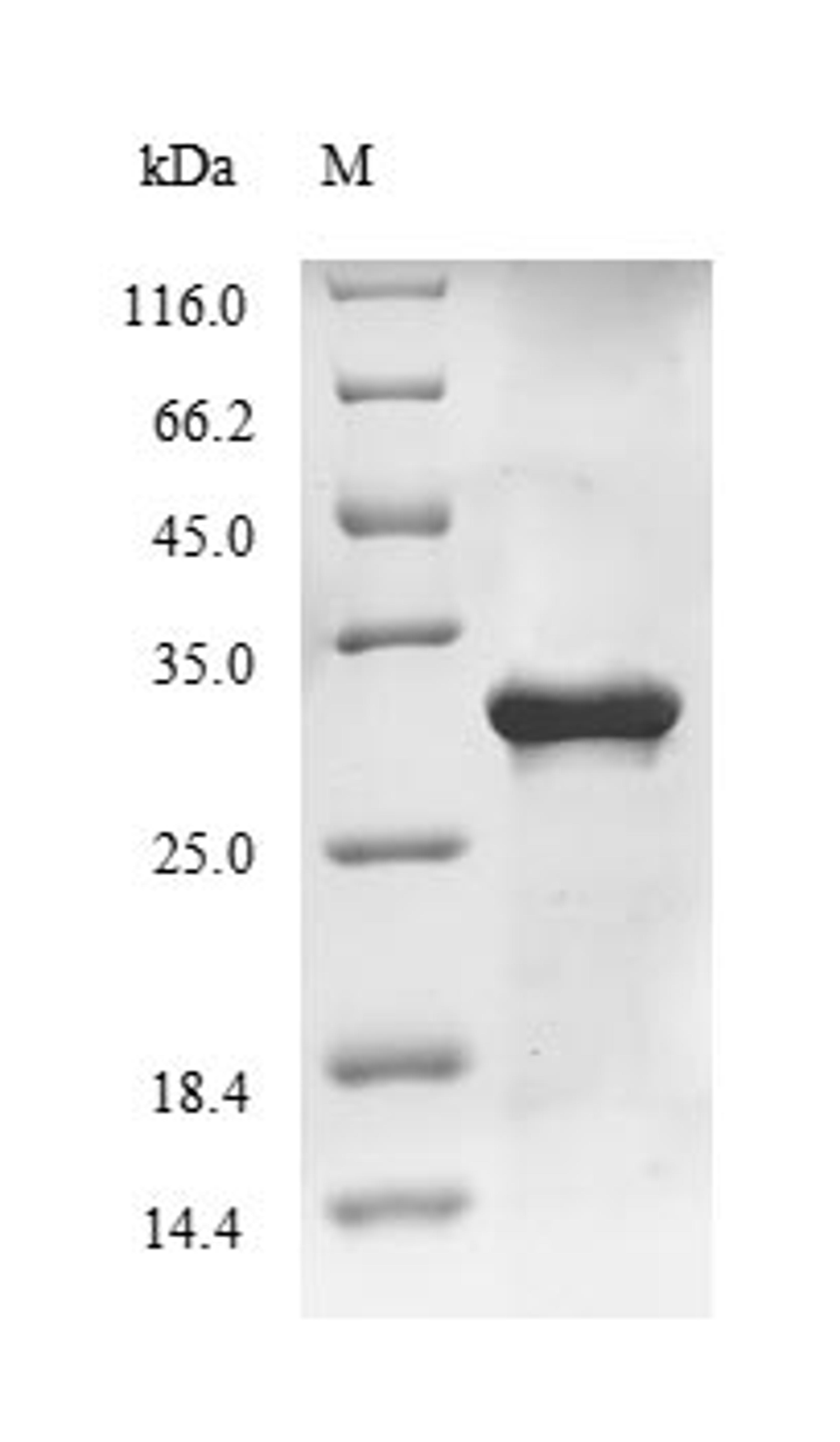 (Tris-Glycine gel) Discontinuous SDS-PAGE (reduced) with 5% enrichment gel and 15% separation gel.