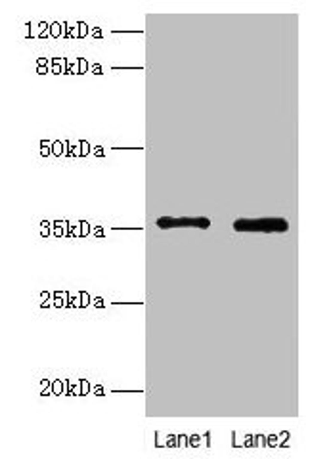 Western blot. All lanes: FOXR2 antibody at 4µg/ml. Lane 1: SH-SY5Y whole cell lysate. Lane 2: Hela whole cell lysate. Secondary. Goat polyclonal to rabbit IgG at 1/10000 dilution. Predicted band size: 36 kDa. Observed band size: 36 kDa