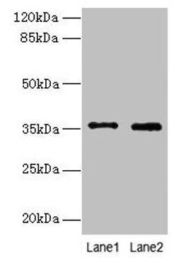 Western blot. All lanes: FOXR2 antibody at 4µg/ml. Lane 1: SH-SY5Y whole cell lysate. Lane 2: Hela whole cell lysate. Secondary. Goat polyclonal to rabbit IgG at 1/10000 dilution. Predicted band size: 36 kDa. Observed band size: 36 kDa