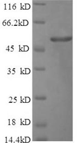 (Tris-Glycine gel) Discontinuous SDS-PAGE (reduced) with 5% enrichment gel and 15% separation gel.