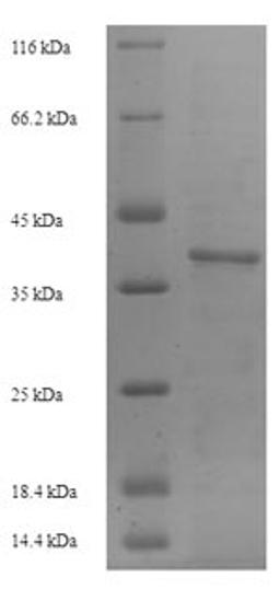 (Tris-Glycine gel) Discontinuous SDS-PAGE (reduced) with 5% enrichment gel and 15% separation gel.