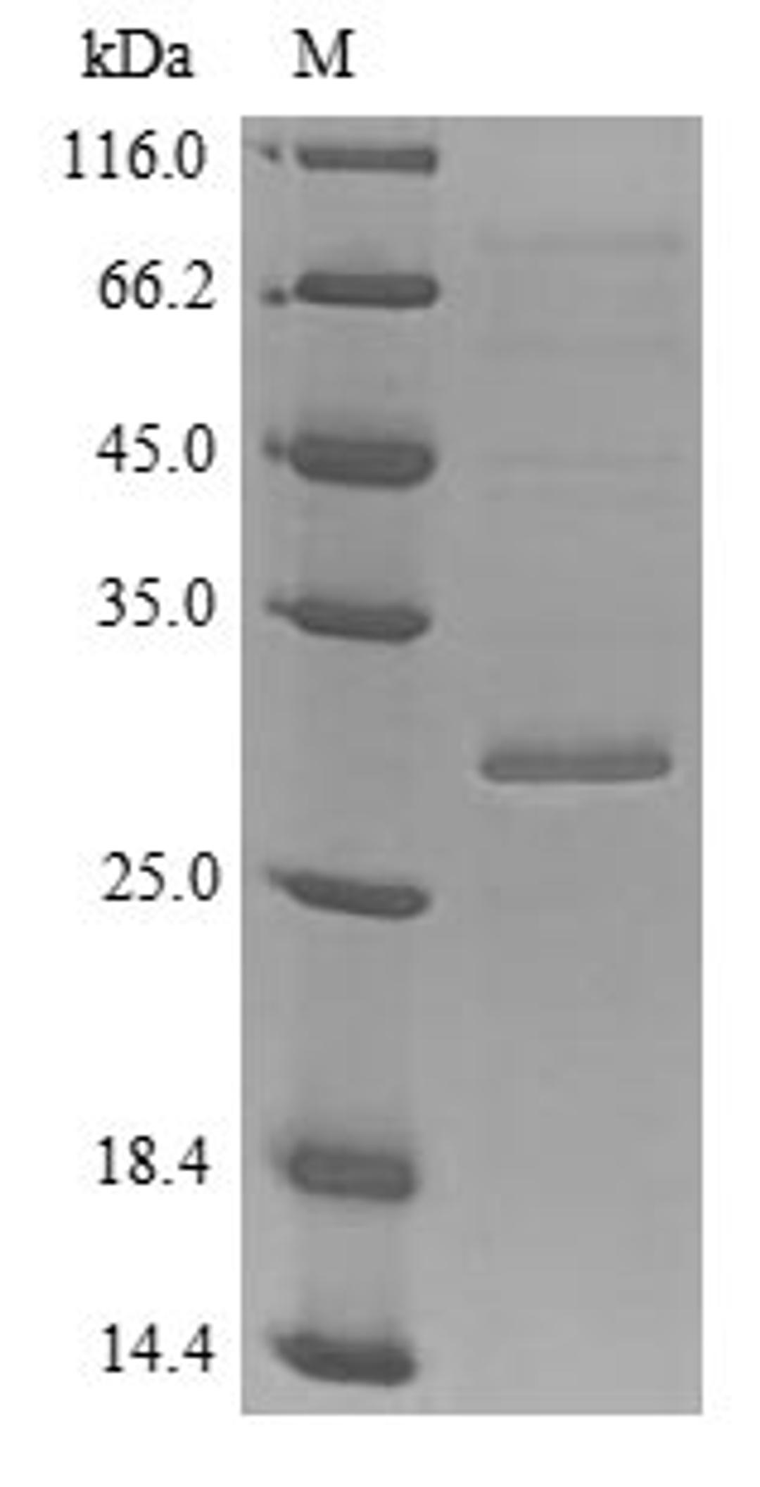 (Tris-Glycine gel) Discontinuous SDS-PAGE (reduced) with 5% enrichment gel and 15% separation gel.