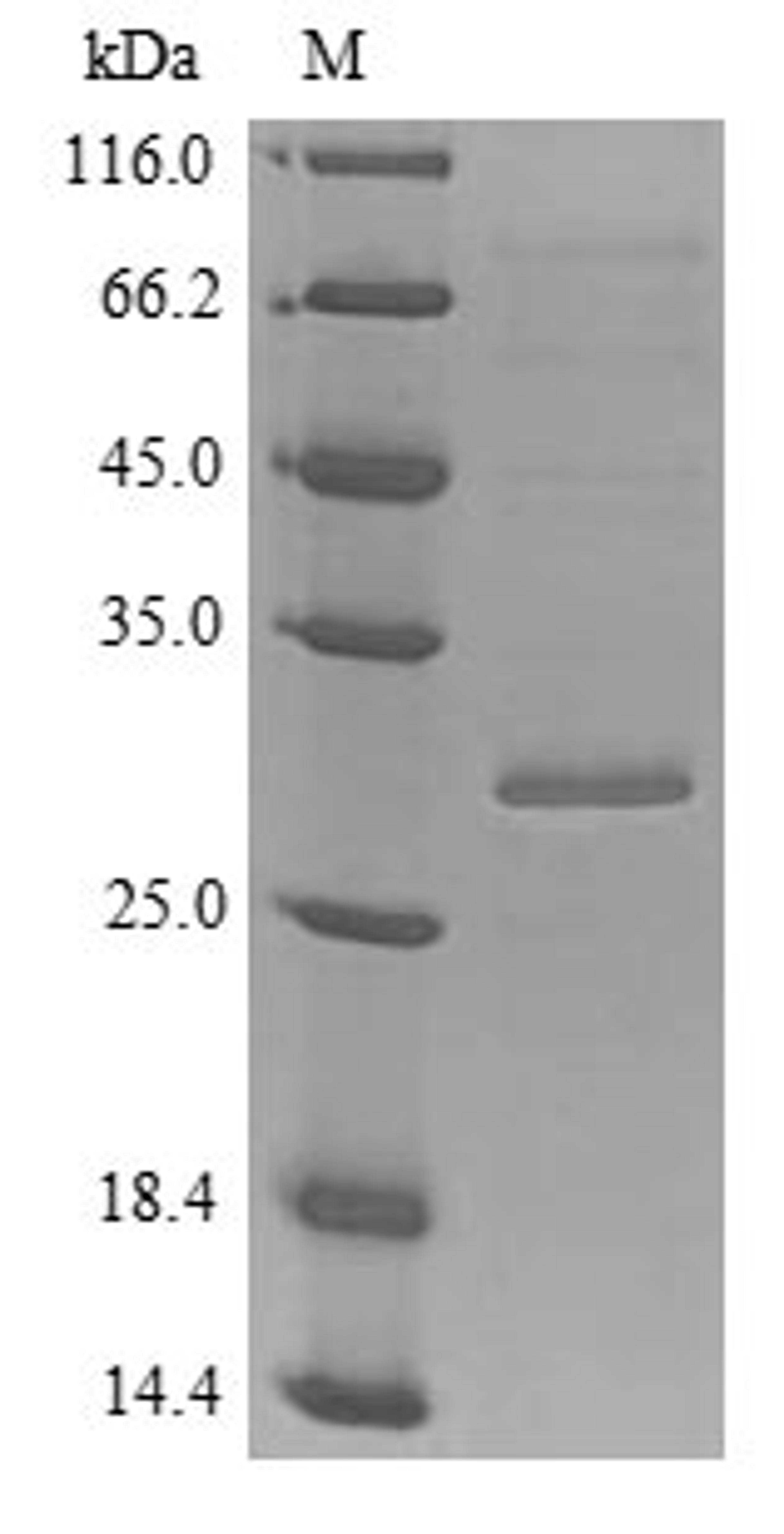 (Tris-Glycine gel) Discontinuous SDS-PAGE (reduced) with 5% enrichment gel and 15% separation gel.