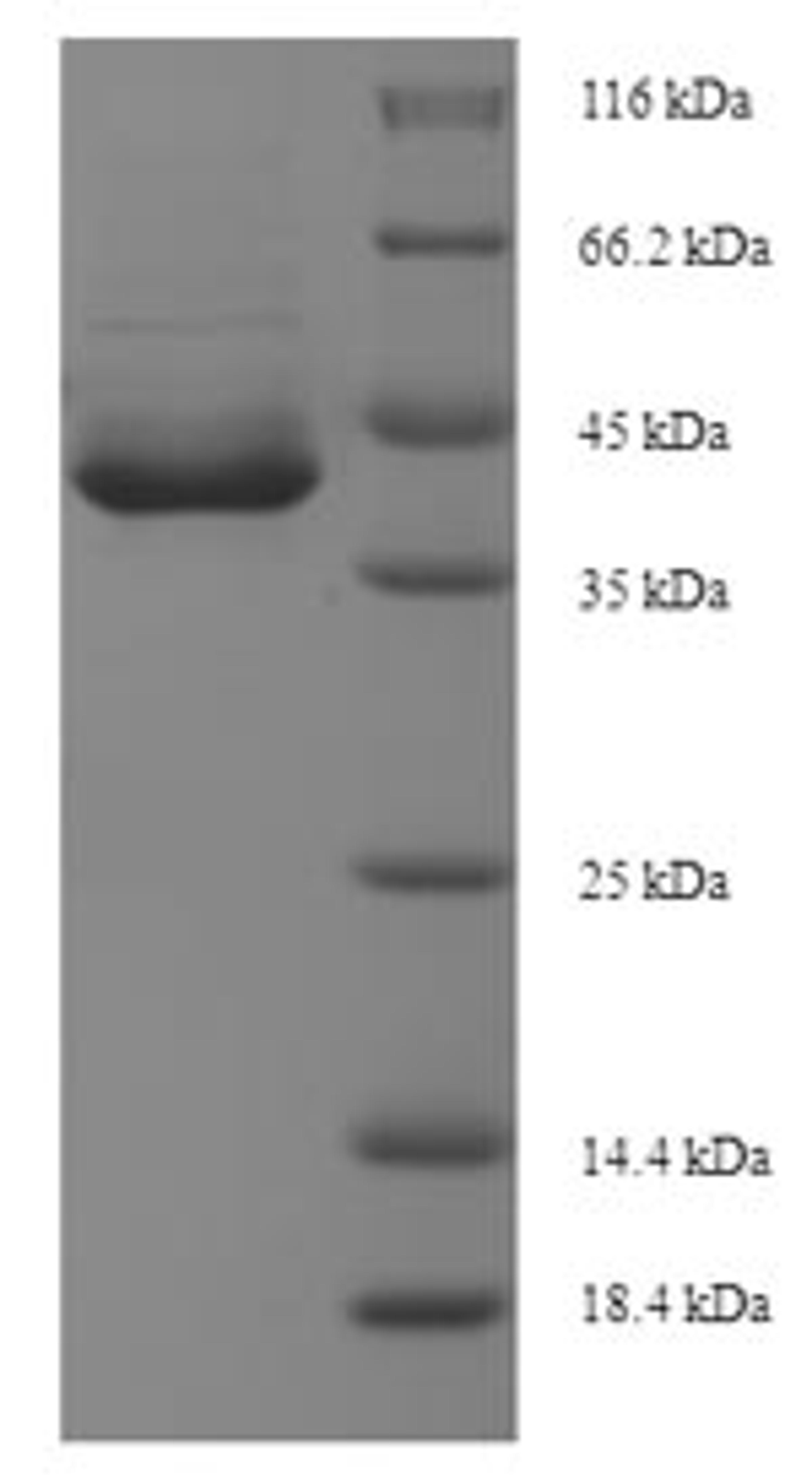 (Tris-Glycine gel) Discontinuous SDS-PAGE (reduced) with 5% enrichment gel and 15% separation gel.
