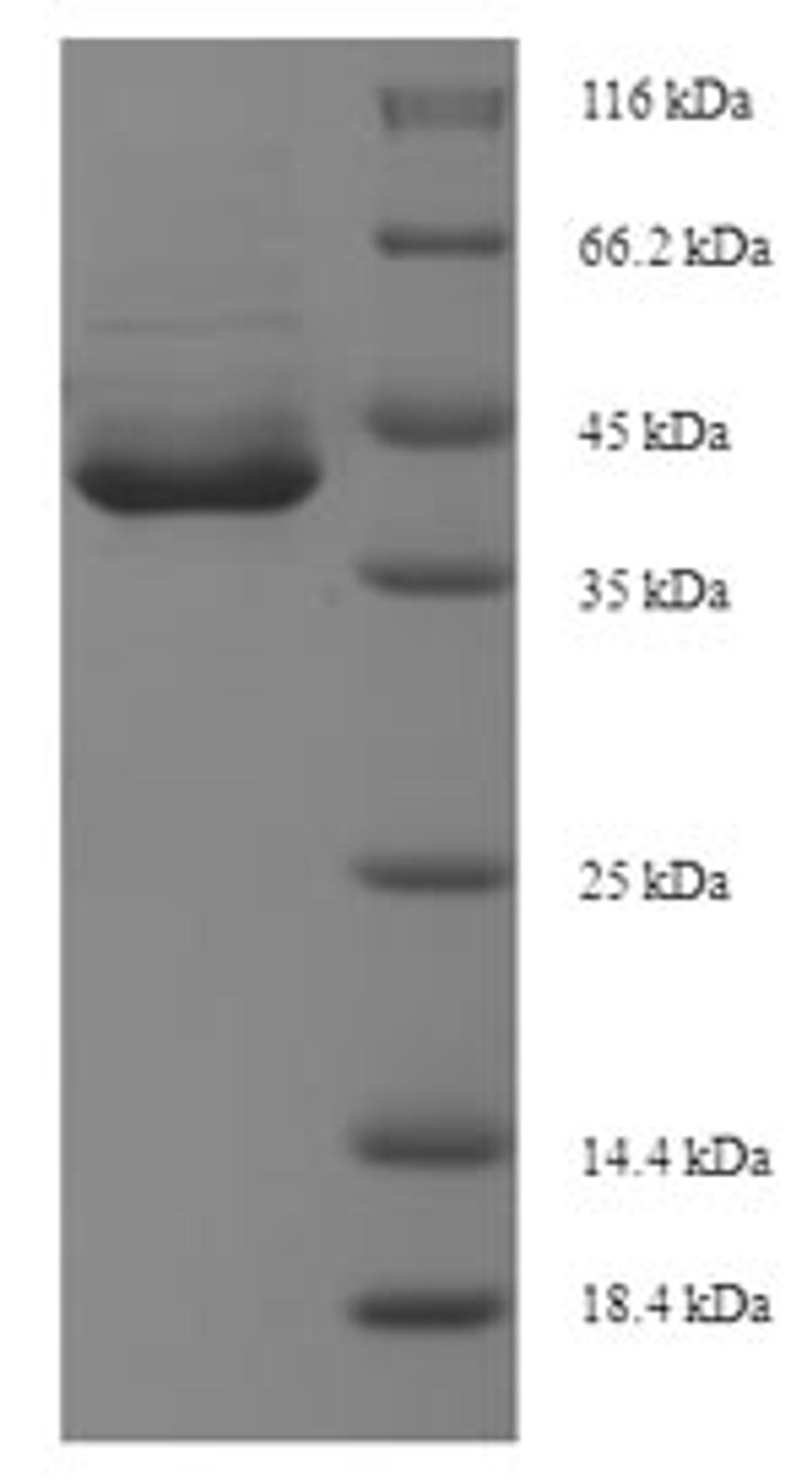 (Tris-Glycine gel) Discontinuous SDS-PAGE (reduced) with 5% enrichment gel and 15% separation gel.
