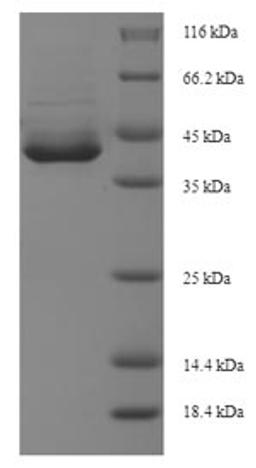 (Tris-Glycine gel) Discontinuous SDS-PAGE (reduced) with 5% enrichment gel and 15% separation gel.